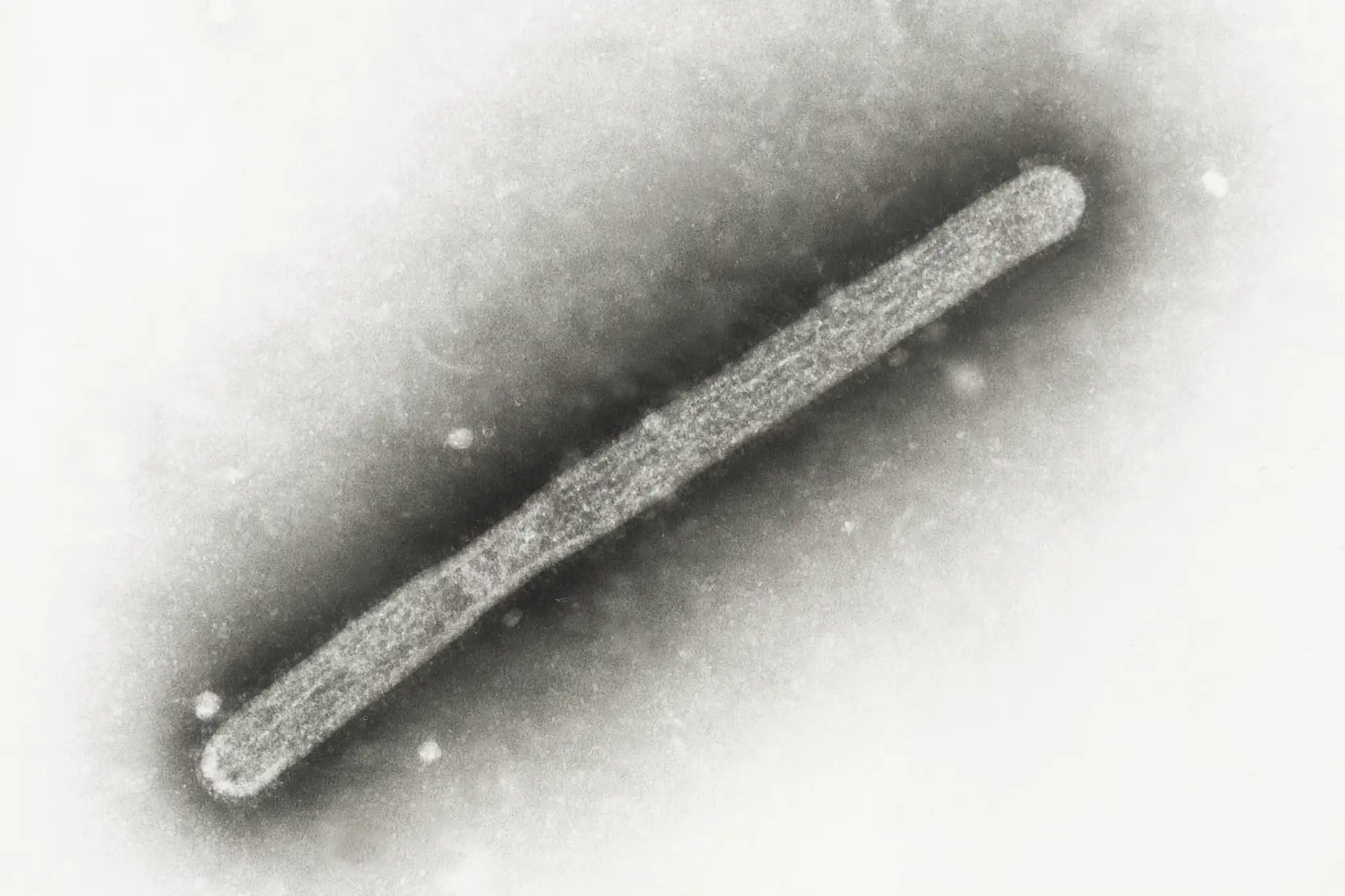 Na snímke z elektrónového mikroskopu z roku 2005 vírus vtáčej chrípky A/H5N1. 