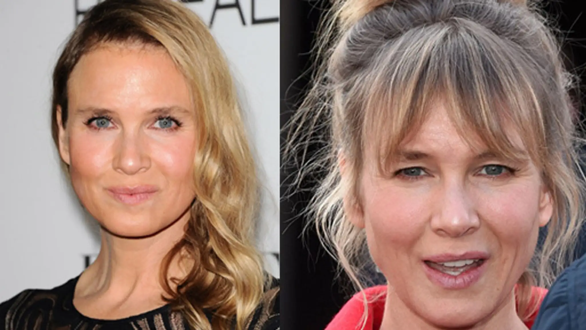 botox.jpg