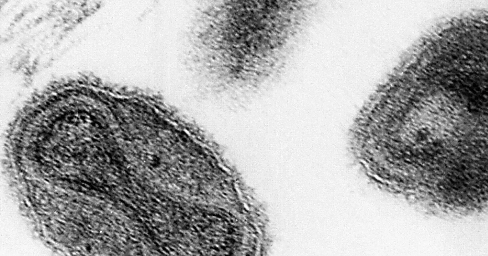 Forgotten_Smallpox-c1613ffb0eb542bfb183650745179c2c.JPEG