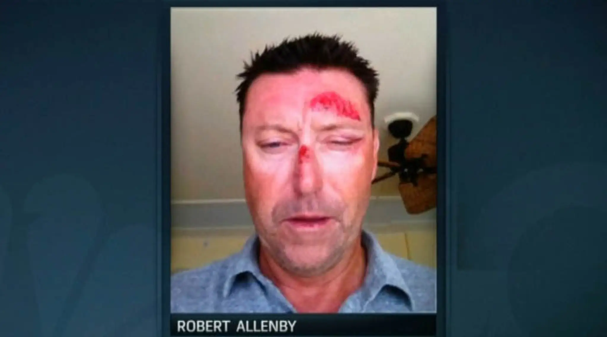 Robert Allenby, golf, unos.