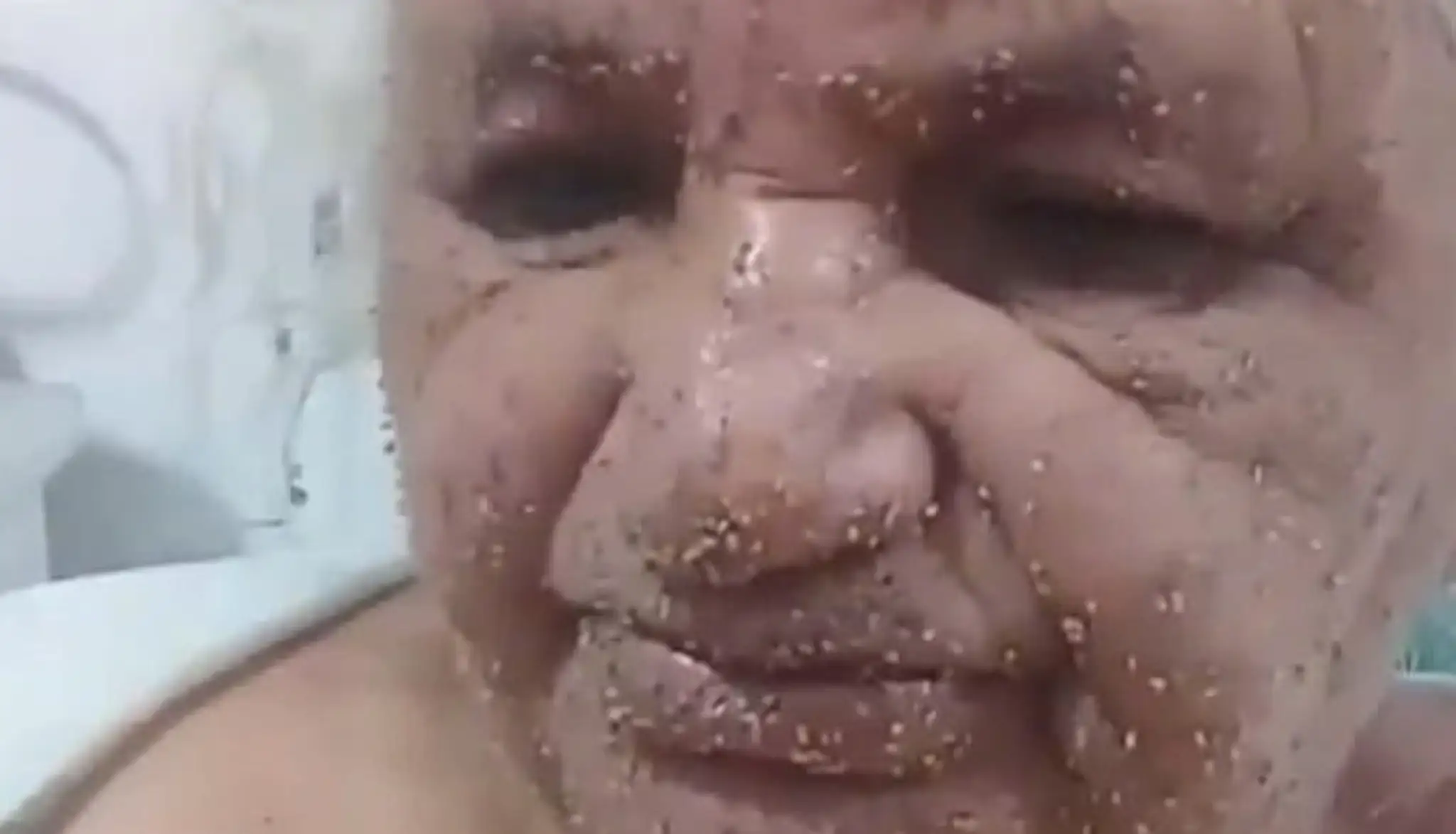 Hoax o pití teplej vody.