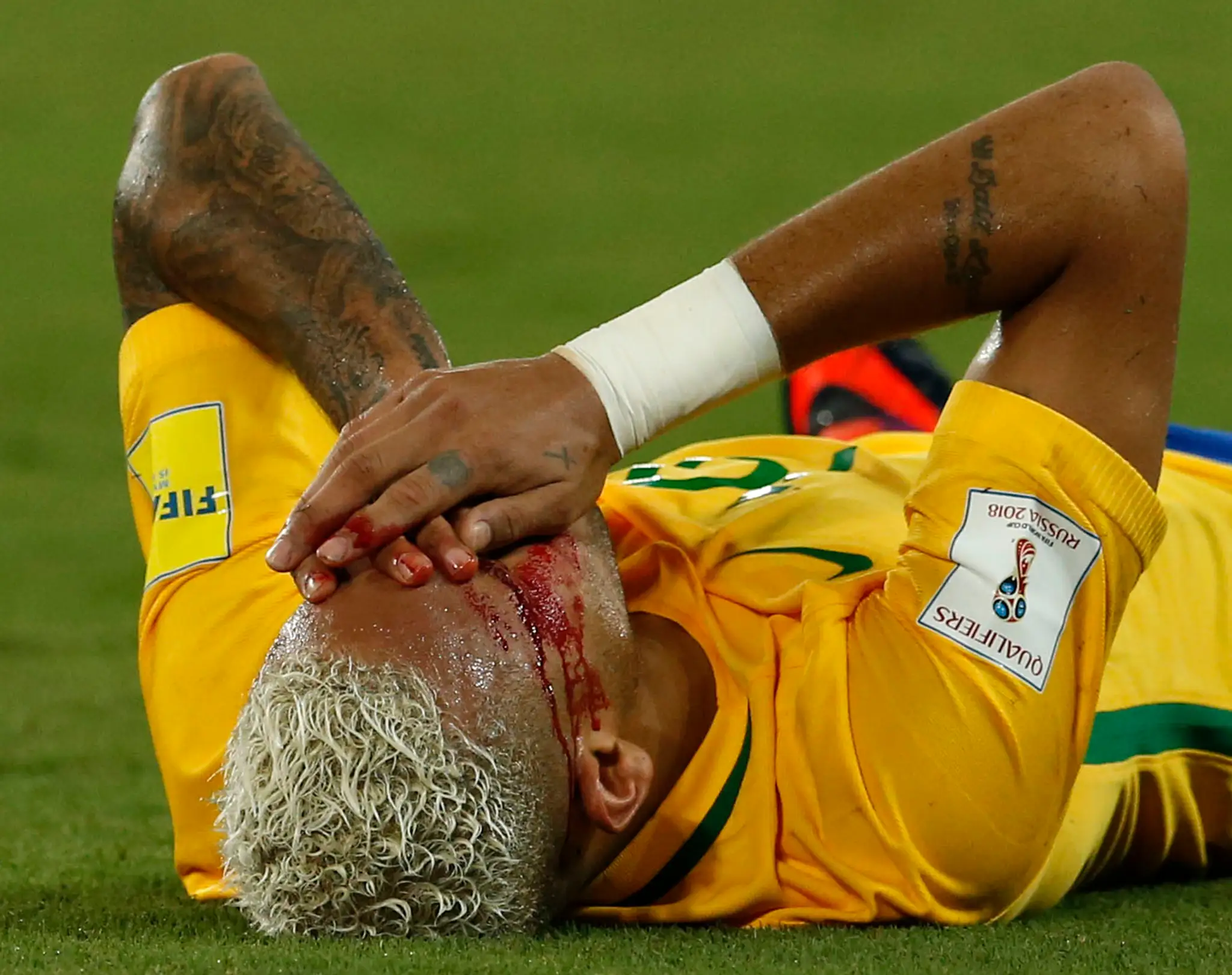 Zranený brazílsky hráč Neymar v 9. kole juhoamerickej kvalifikácie o postup na futbalové MS 2018 proti Bolívii.