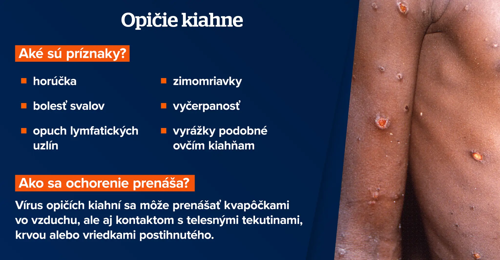 priznaky