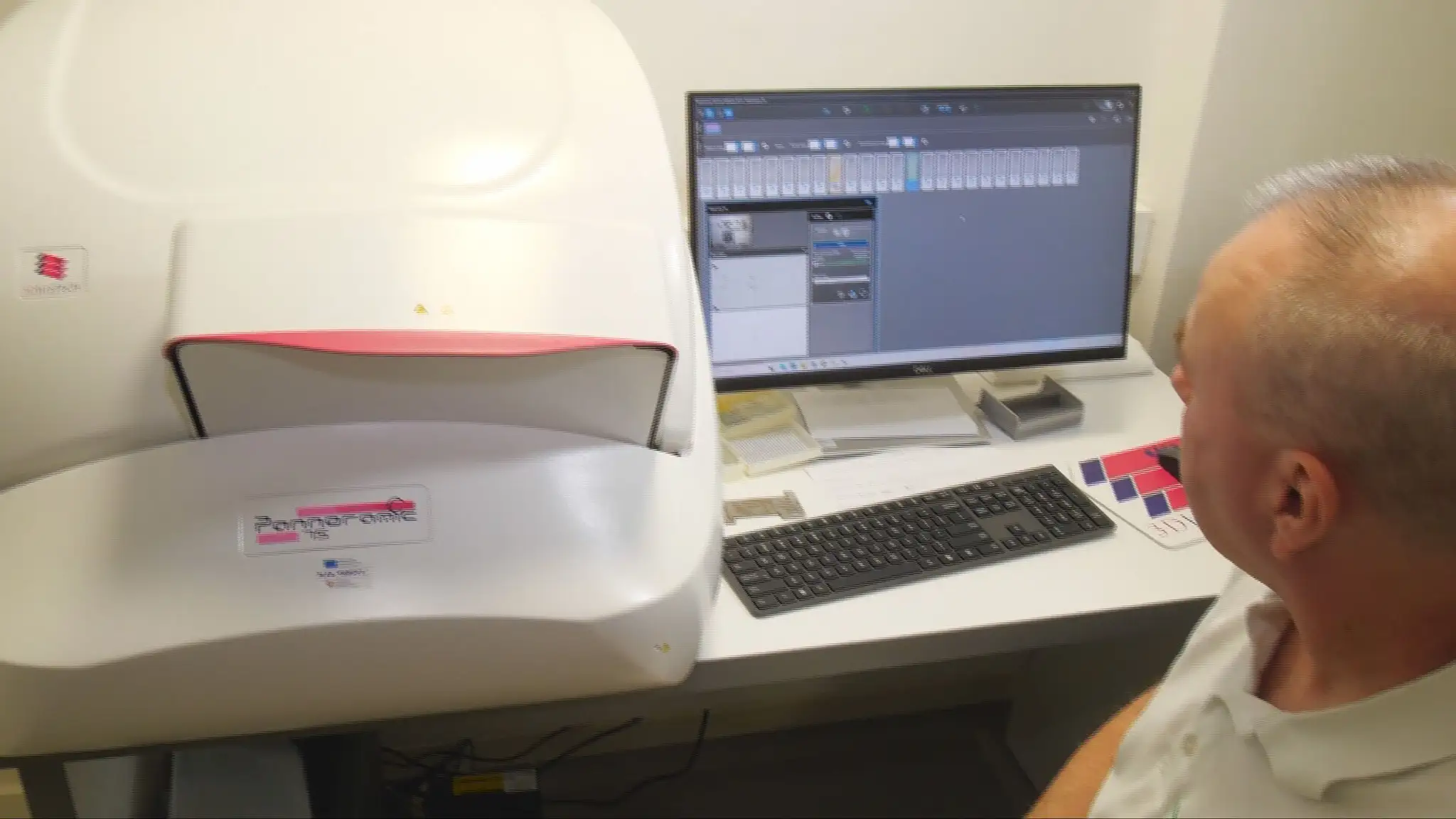 Nová technológia na diagnostiku rakoviny