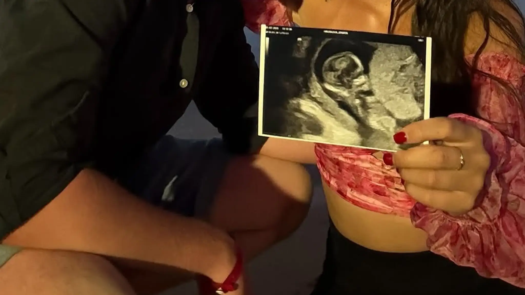 Jennifer z Ruže sa stane mamou. 