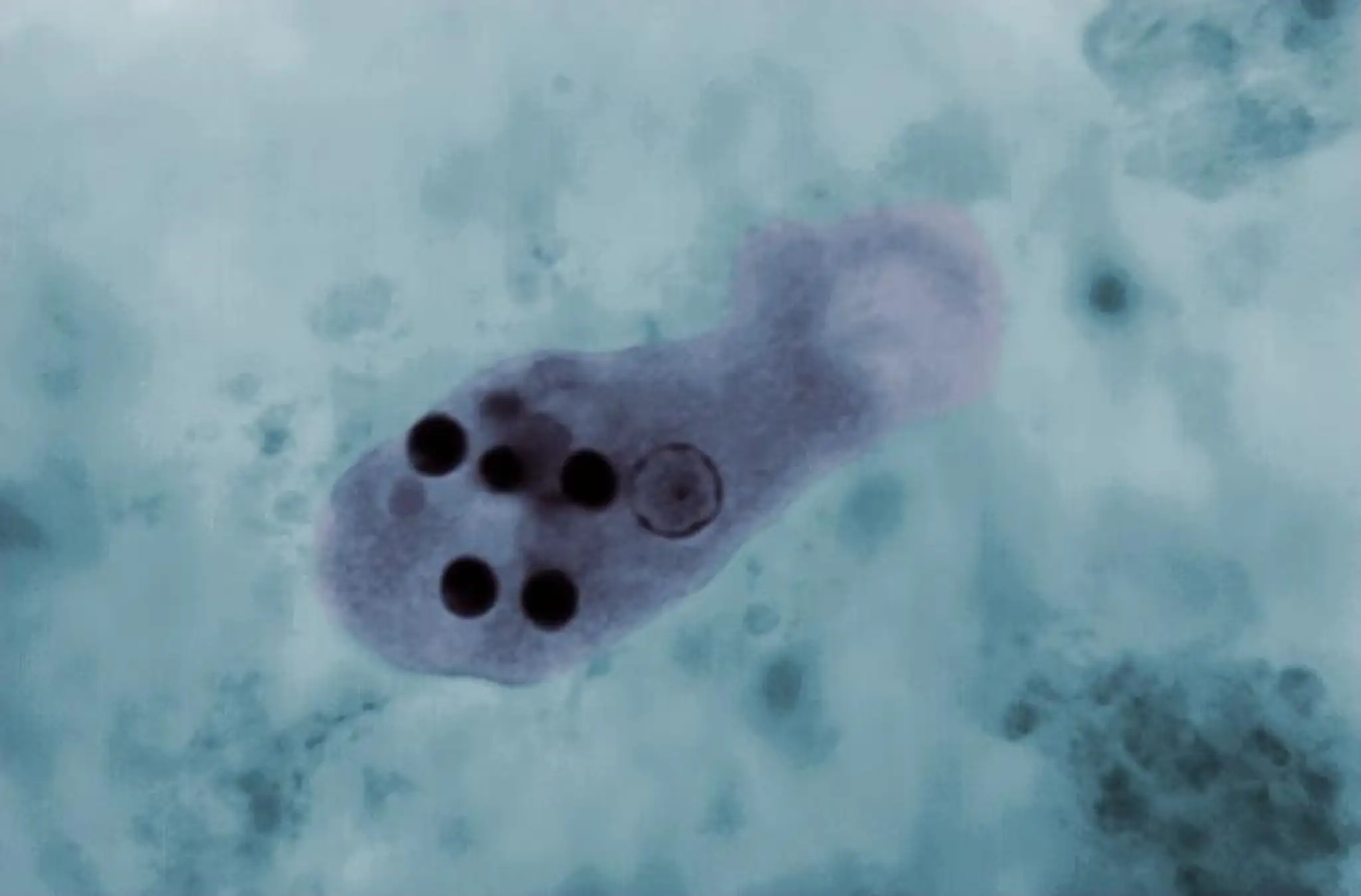 Améba Entamoeba histolytica