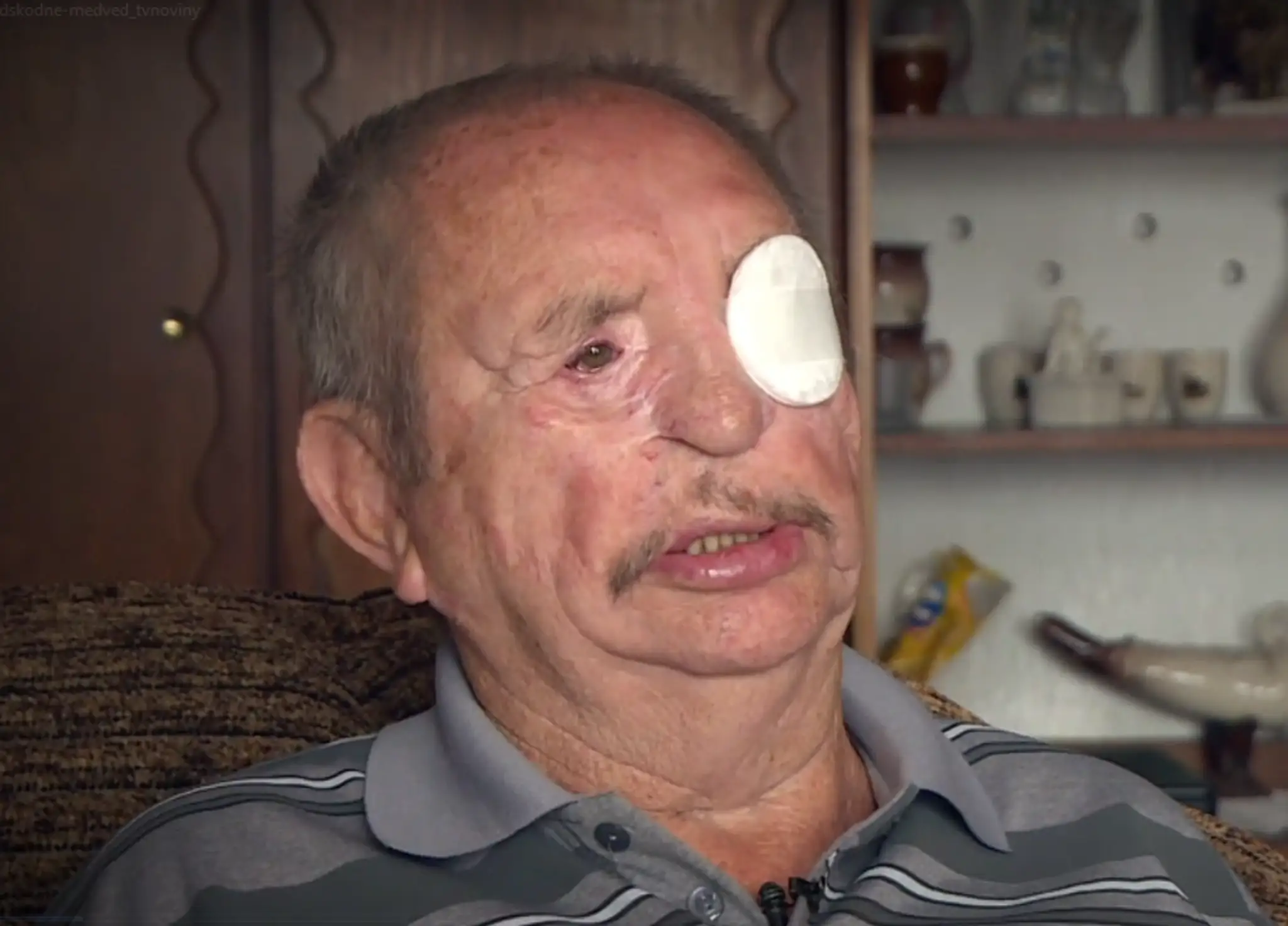 Jána Gejdoša z Liptovských Sliačov zmrzačil medveď