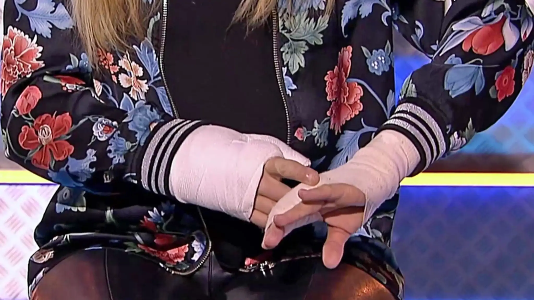 Markíza 30 - Lina Mayer utrpela pred nakrúcaním šou Tvoja tvár znie povedome vážny úraz