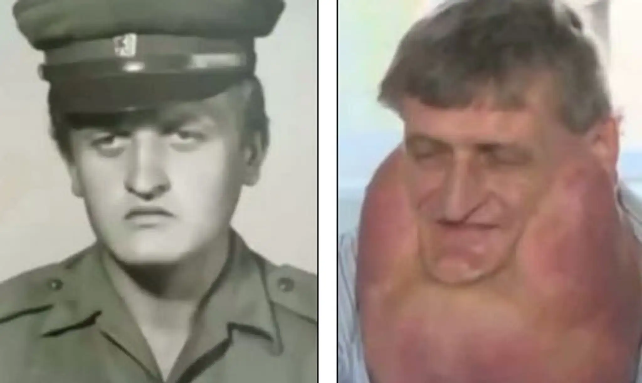stefan operacia.jpg