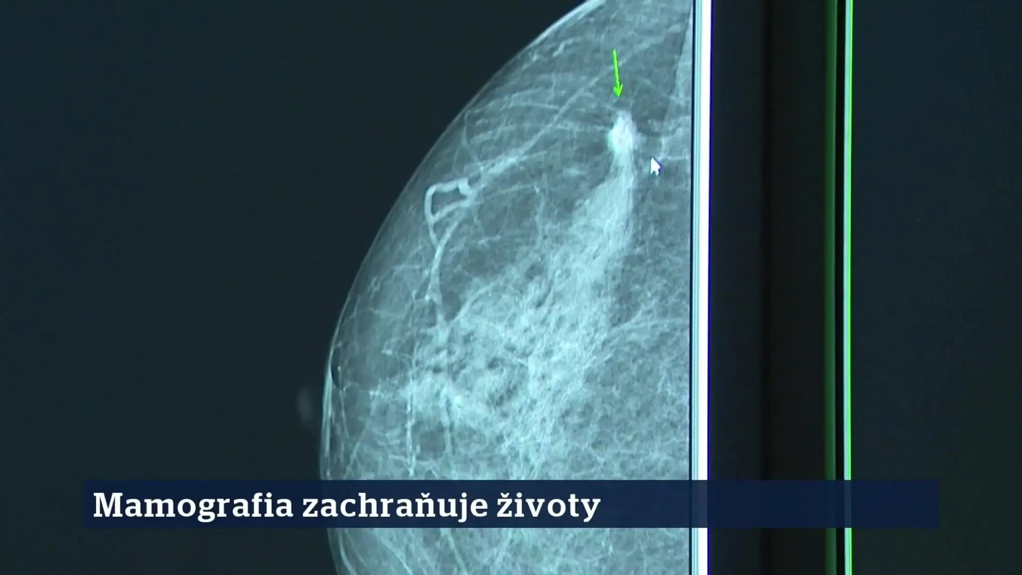 8. epizóda - 0008