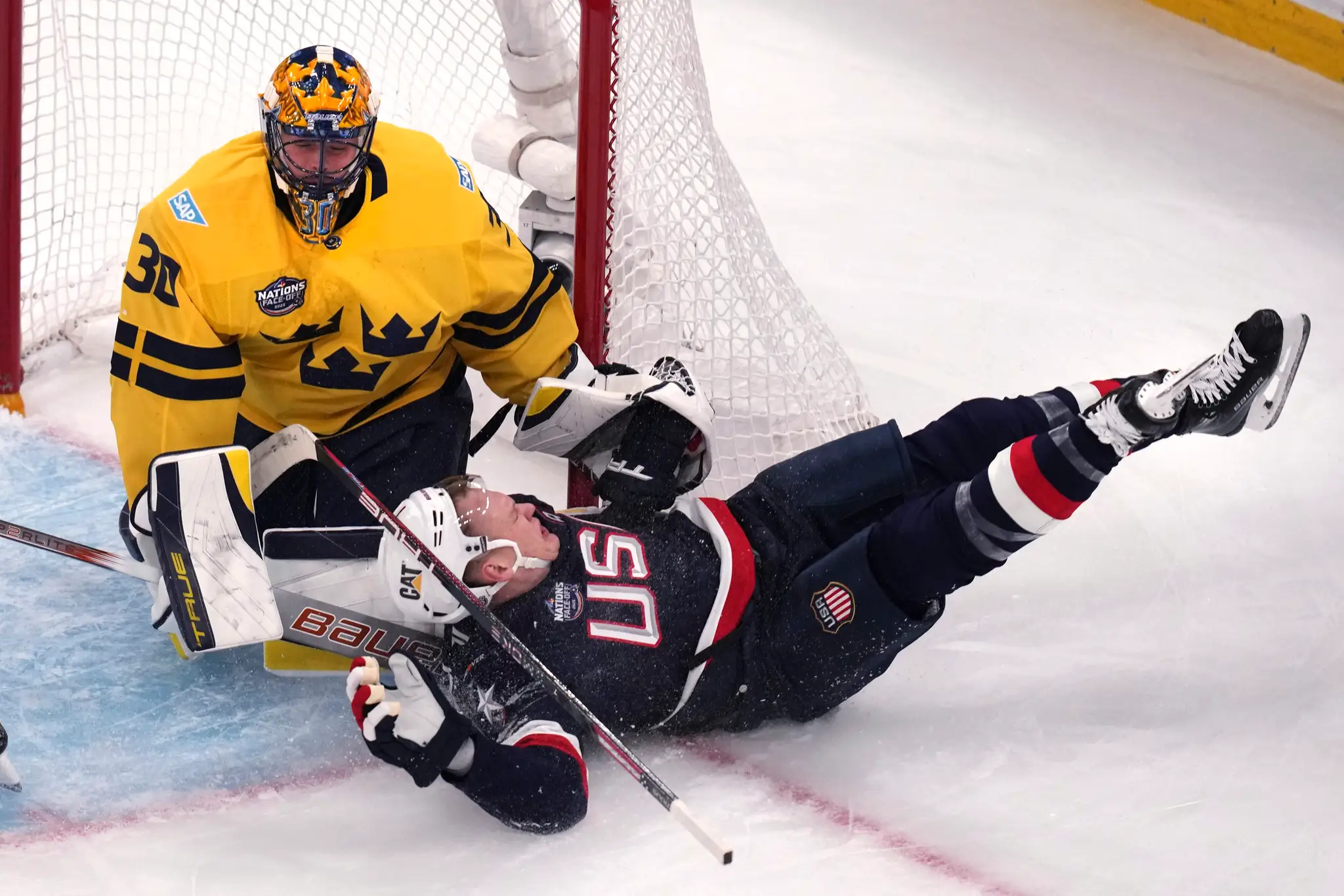 Brady Tkachuk po náraze do bránky zápas nedohral.