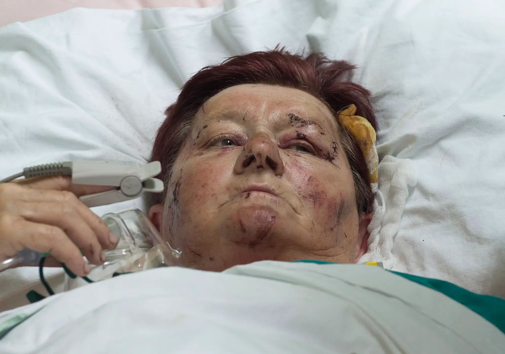 Zranená turistka Helena z okresu Trebišov zostáva hospitalizovaná v Centrálnej klinike v srbskom meste Niš.