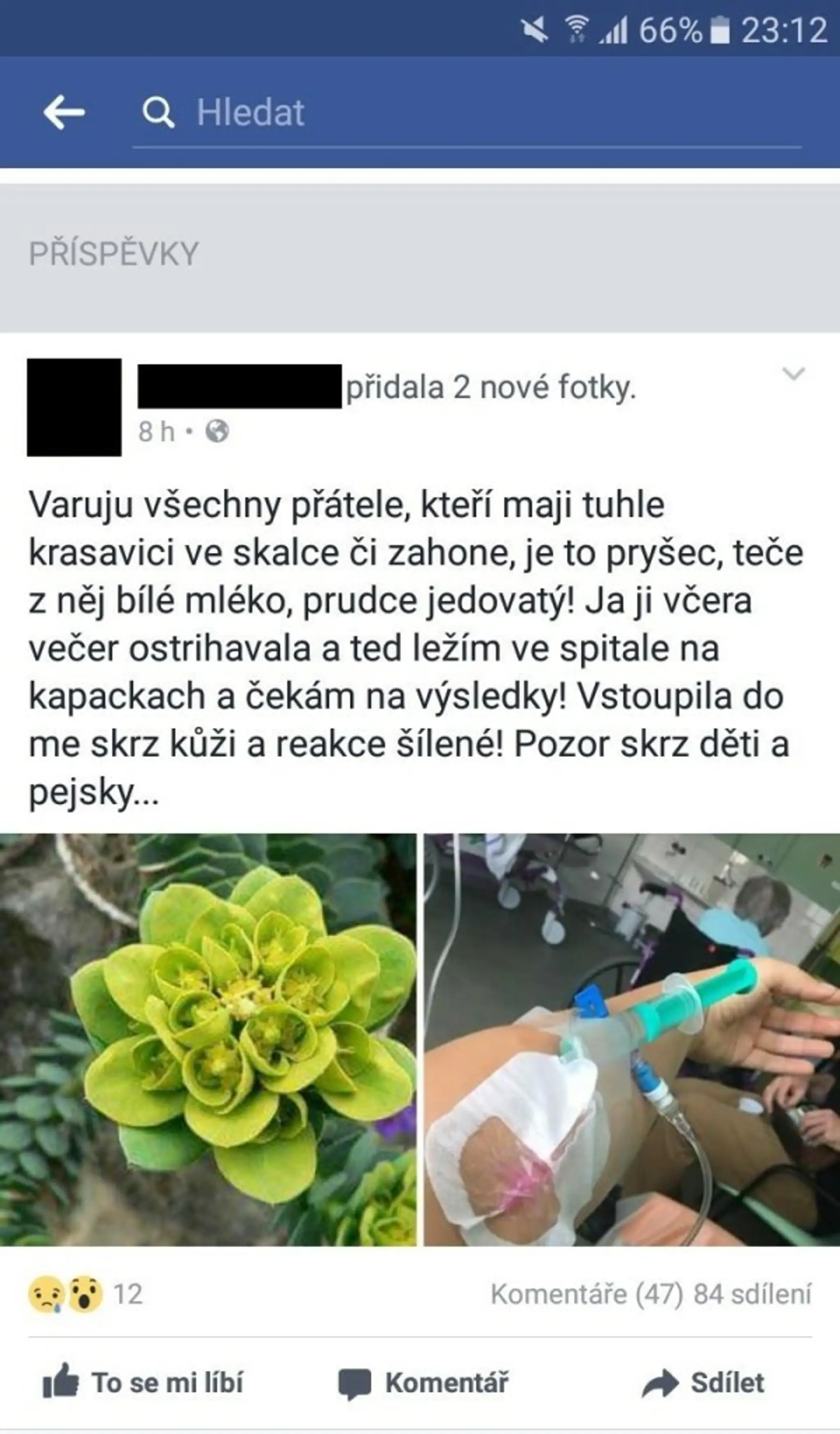 Žena skončila v nemocnici, poranila ju rastlina v skalke.