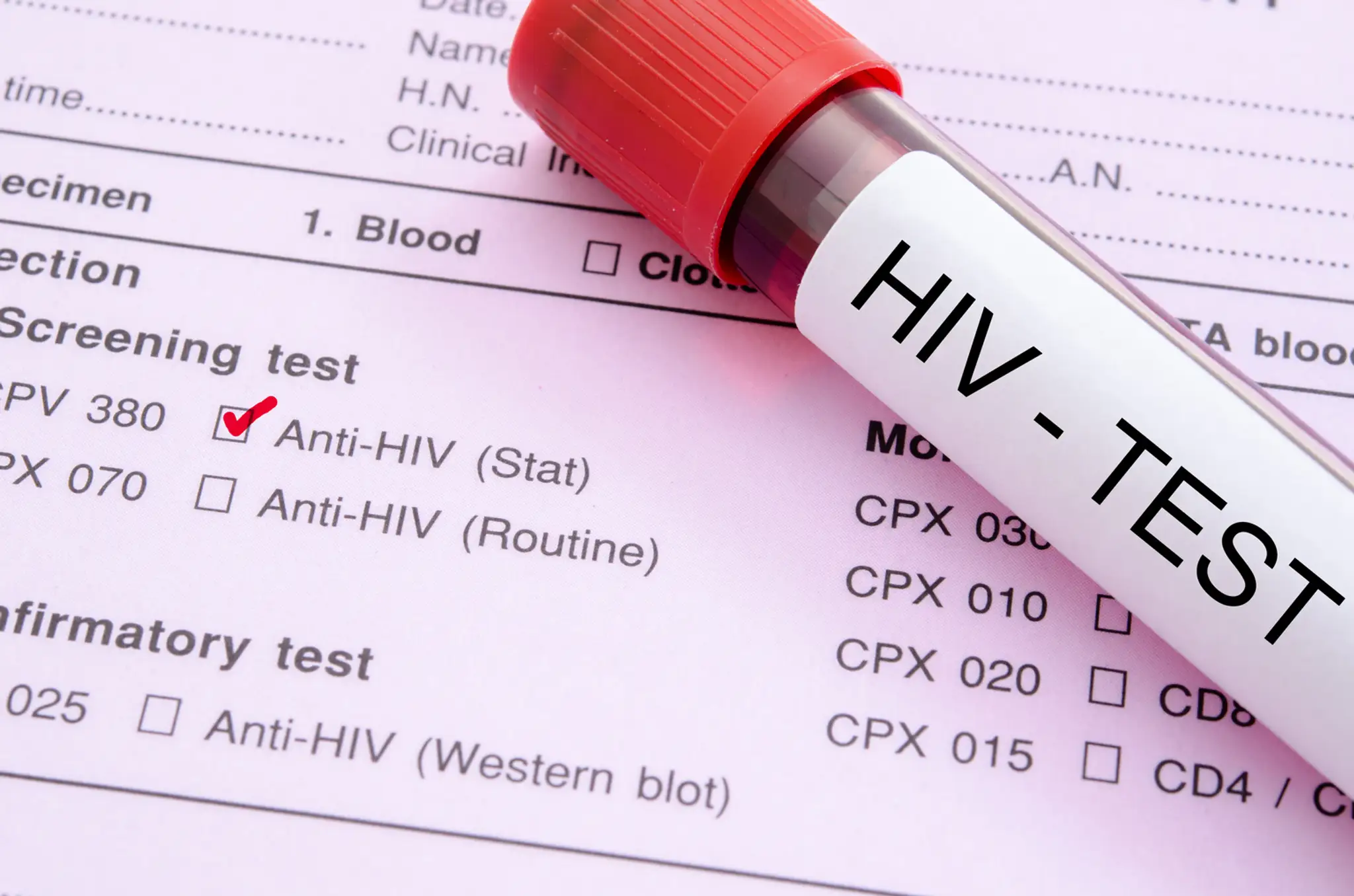 Vírus HIV- ilustračná snímka.