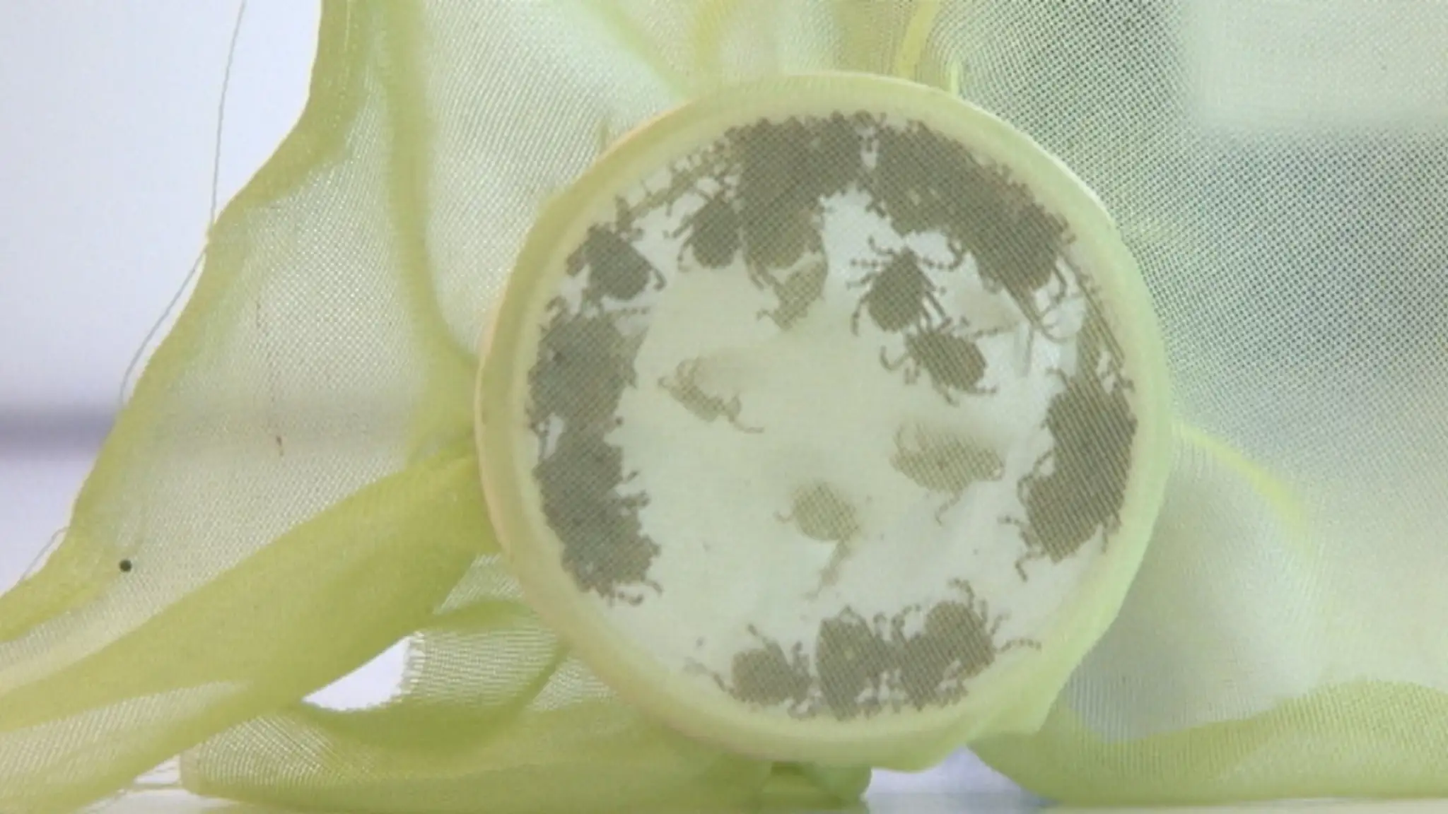 Encefalitída 