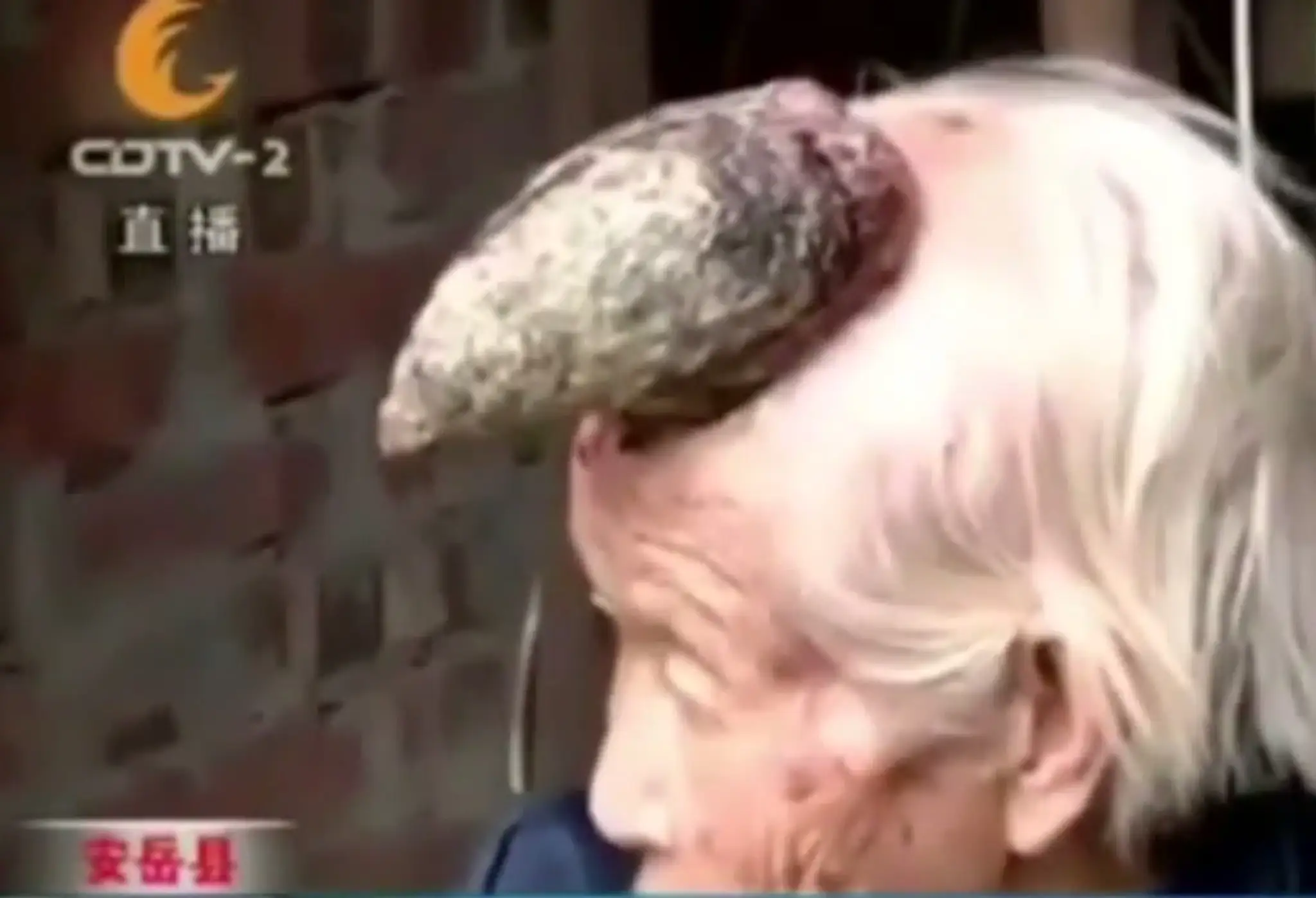 Babička sa na roh neustále sťažuje. Vraj ju hrozne svrbí