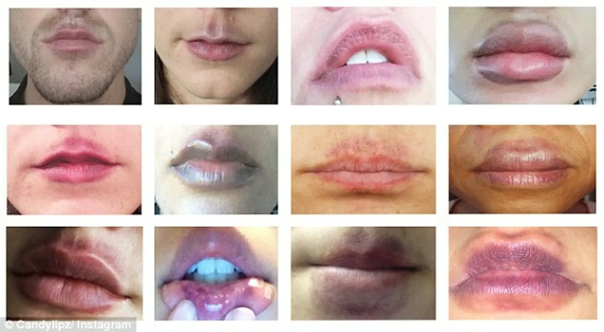 candylipz.jpg