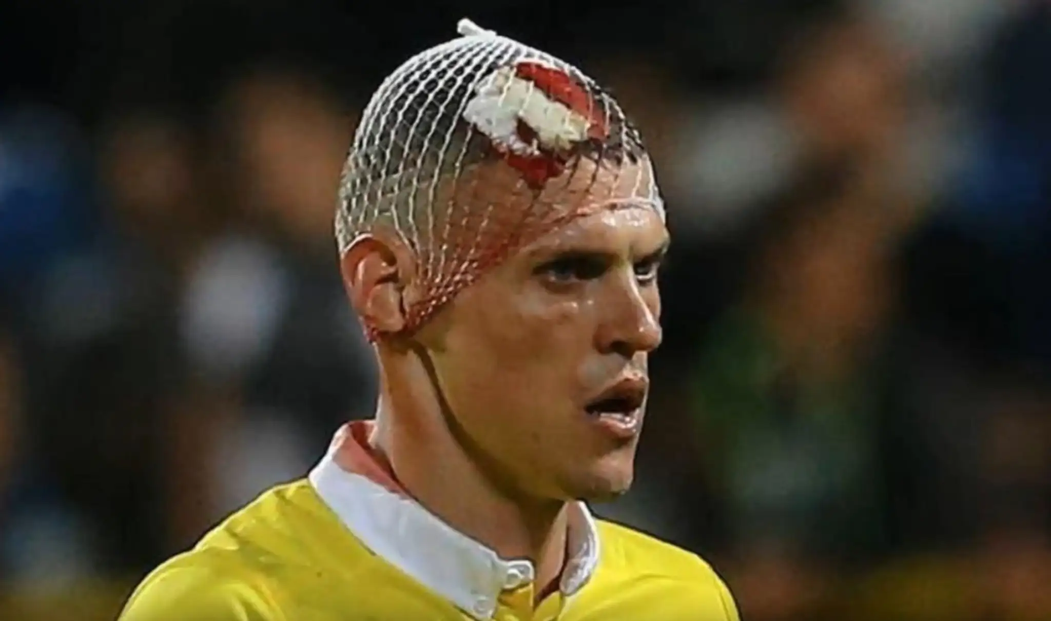 Martin Škrtel s obviazanou hlavou počas zápasu Fenerbahce - Kasimpasa.