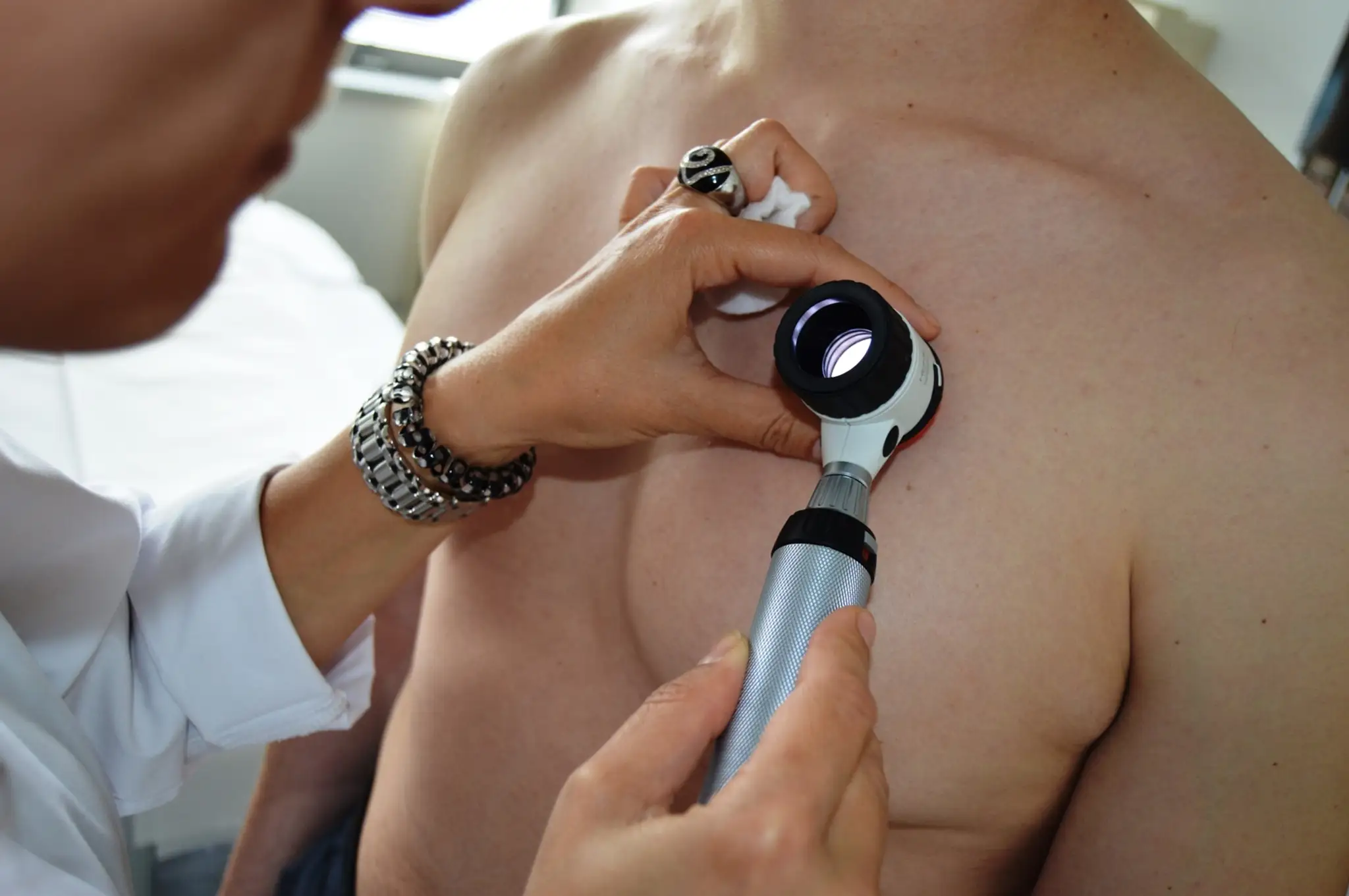 vysetrenie dermatoskopom 2.JPG