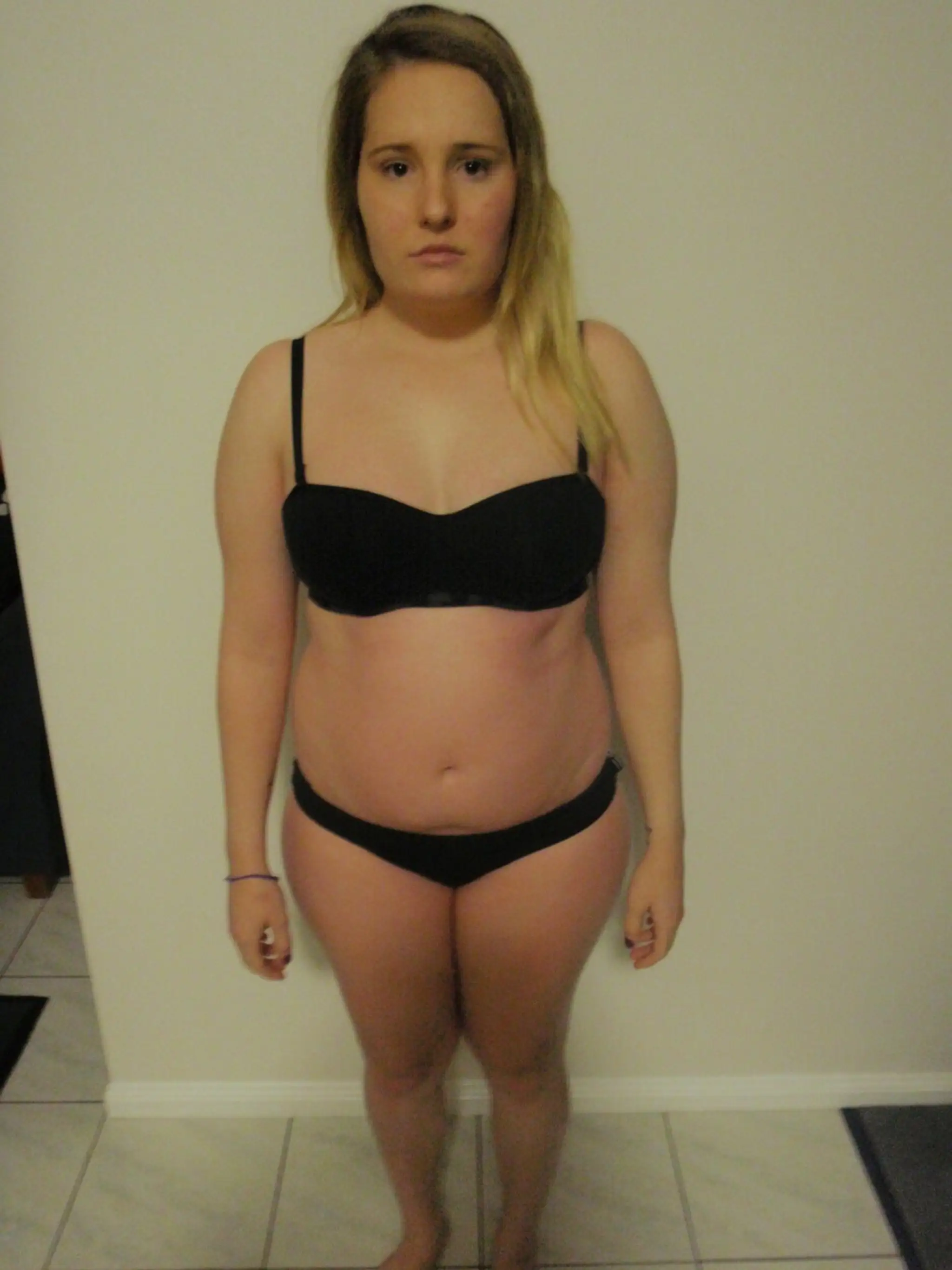 Gemma Walker pred anorexiou.