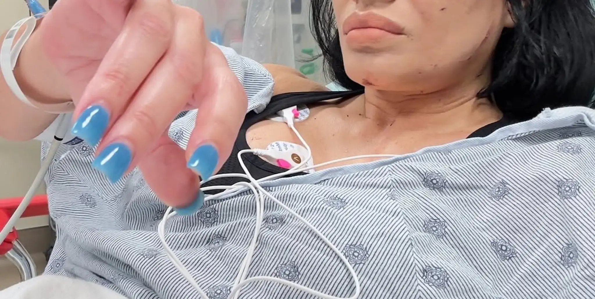Influencerka v nemocnici po nehode v reštaurácii