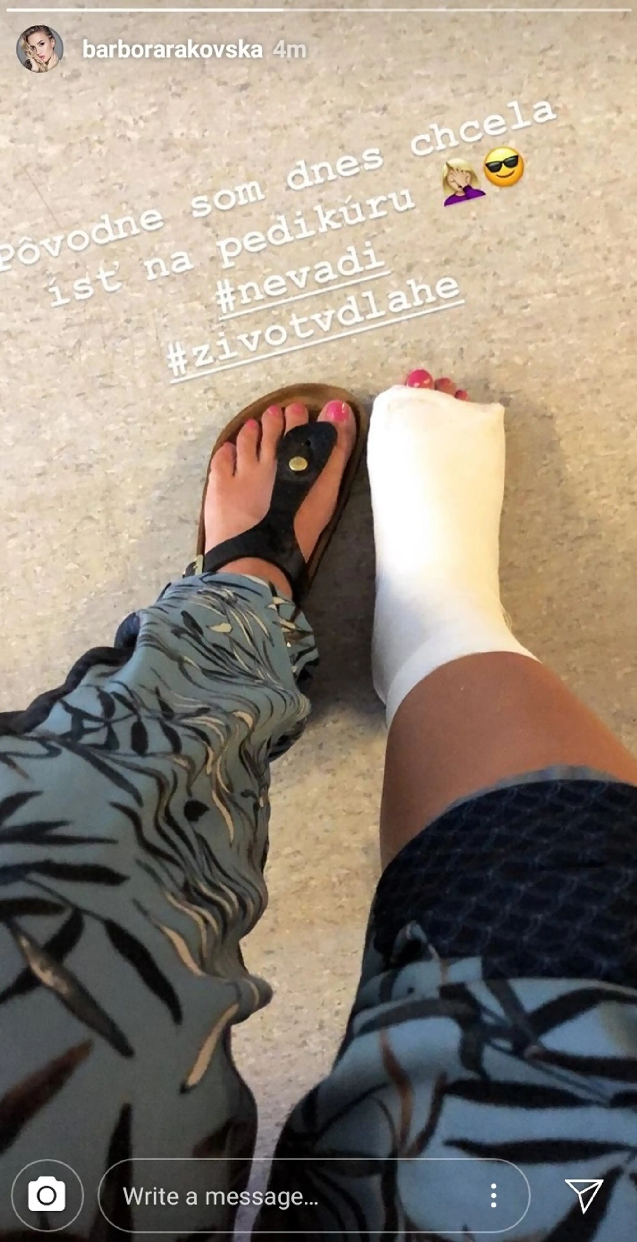 Barbora Rakovská skončila s nohou v sadre