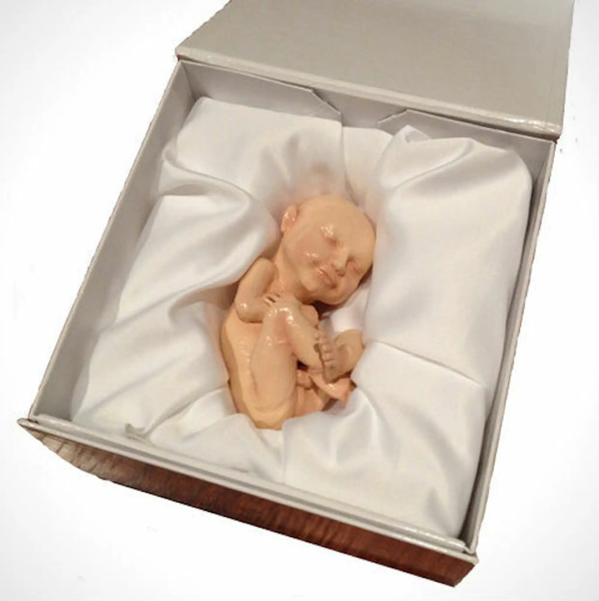 Ešte nenarodené dieťa vytlačené 3D tlačiarňou
