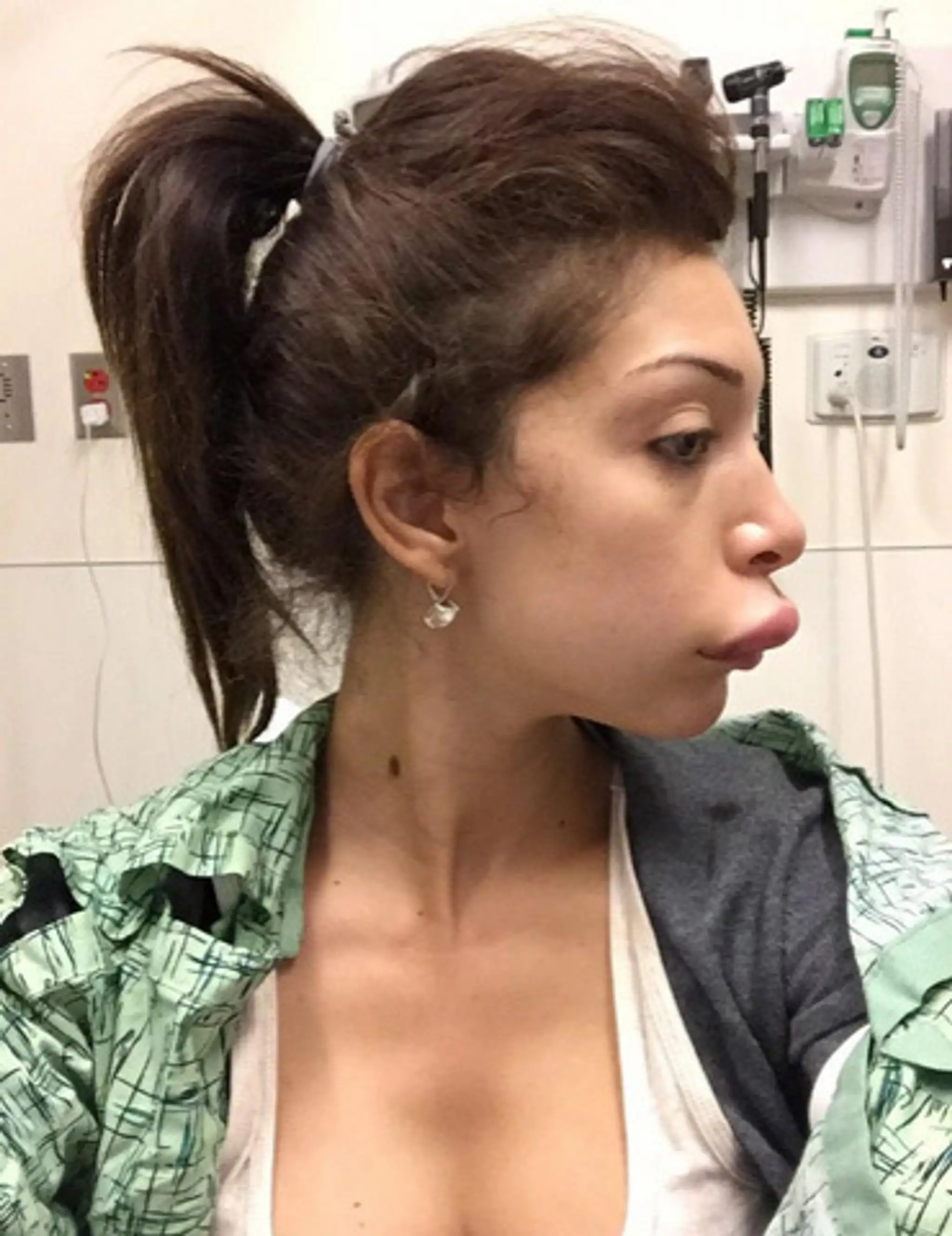 farrah lips2.jpg
