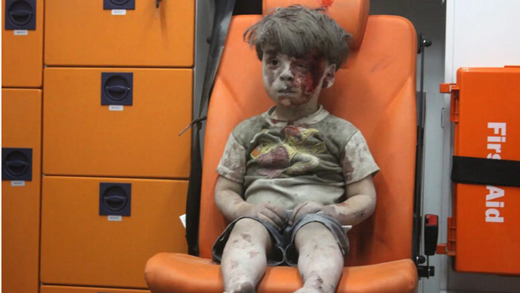Sýrsky chlapec Omran Daqneesh