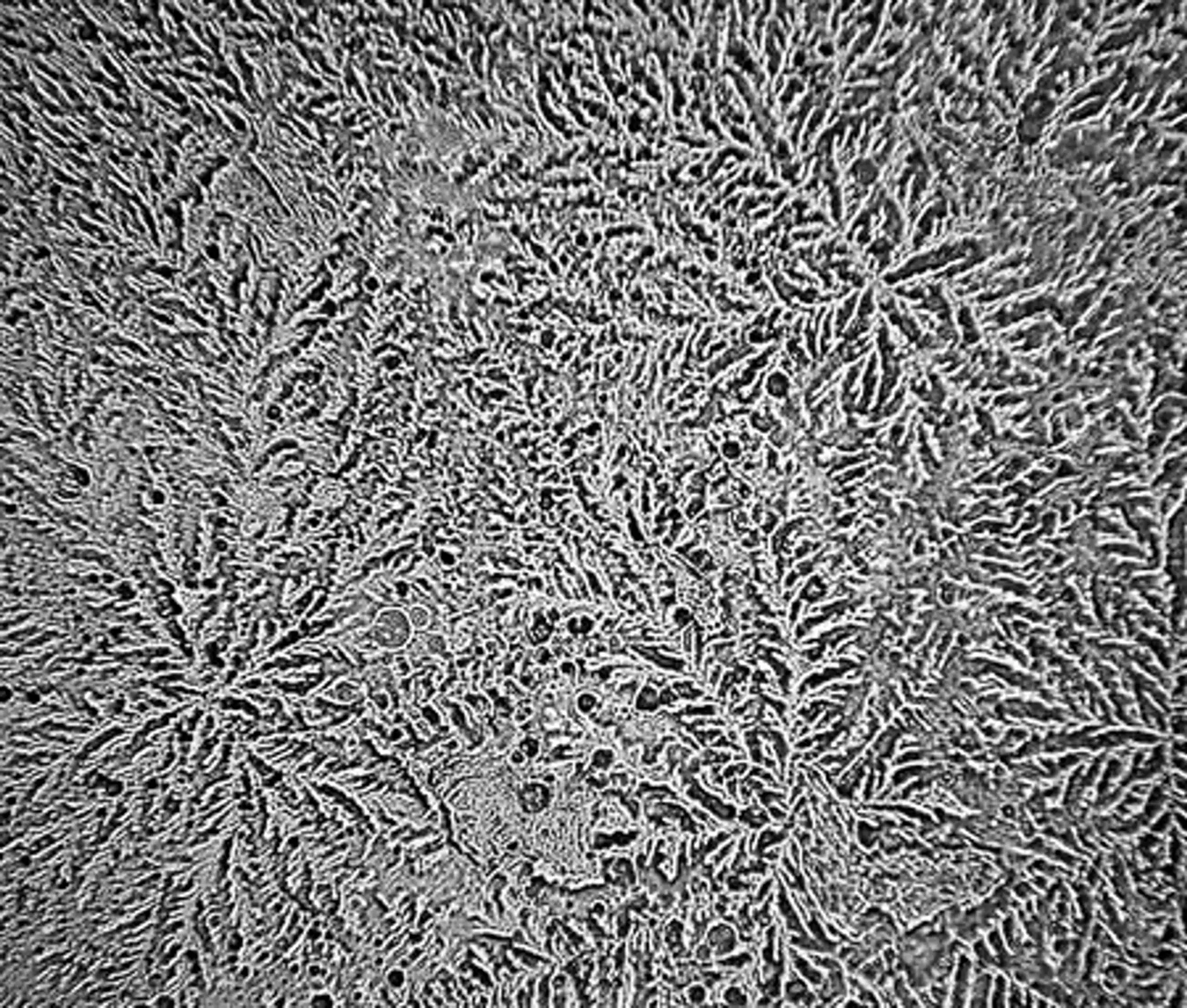 slzy-cibula.jpg