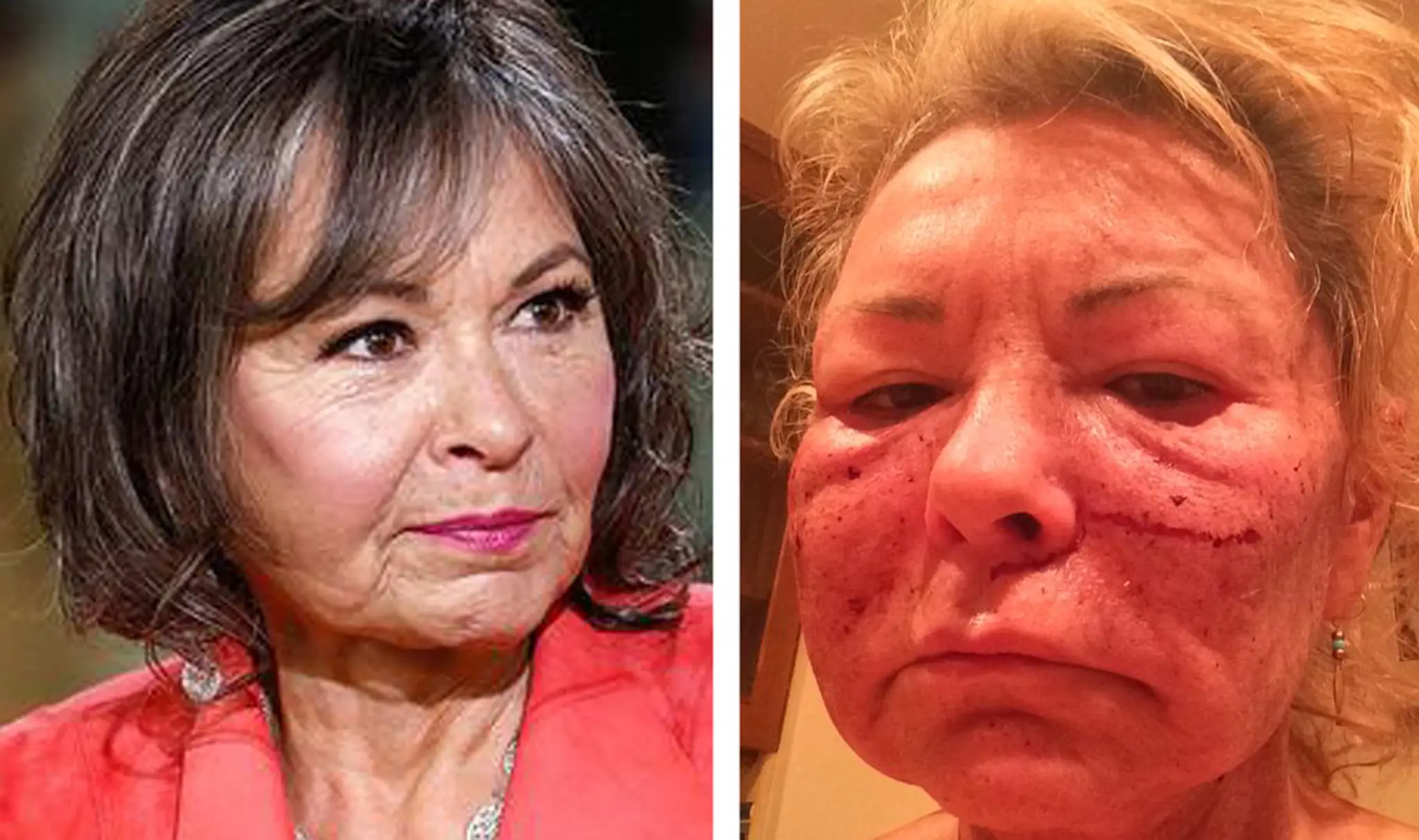 Roseanne Barr
