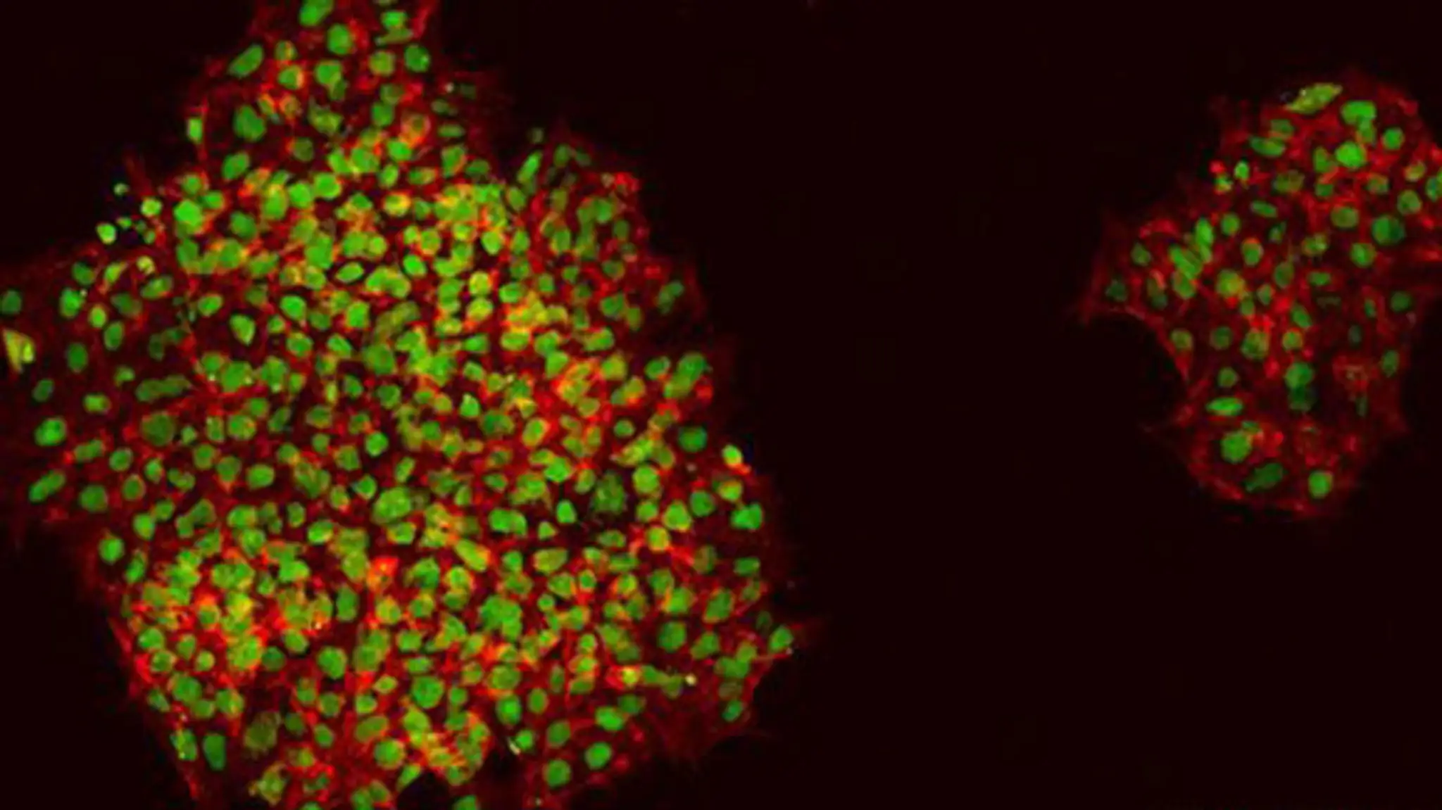 _74404000_ipsc-derivedkeratinocytescolonies-3.jpg