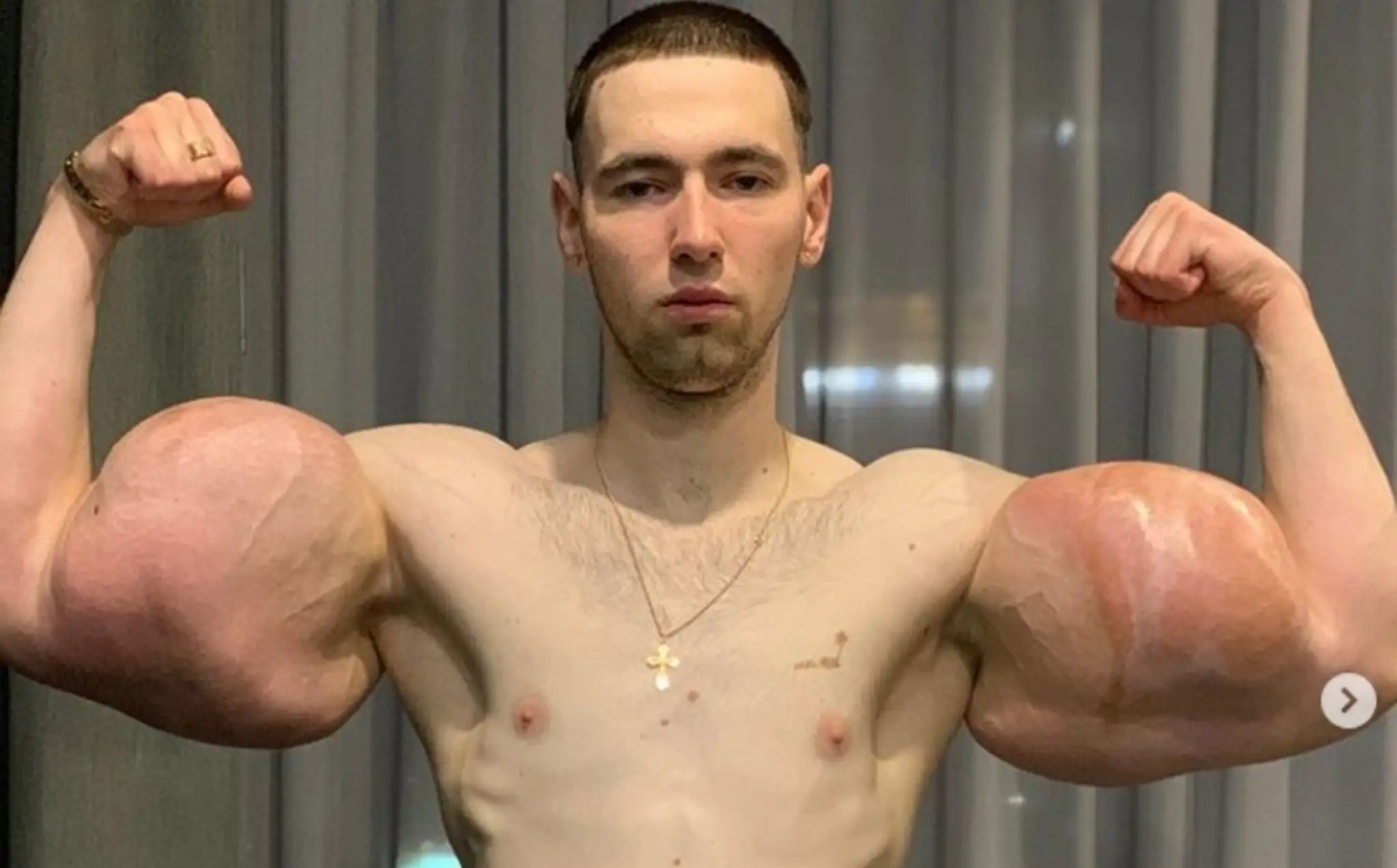 Zhorená časť domu.