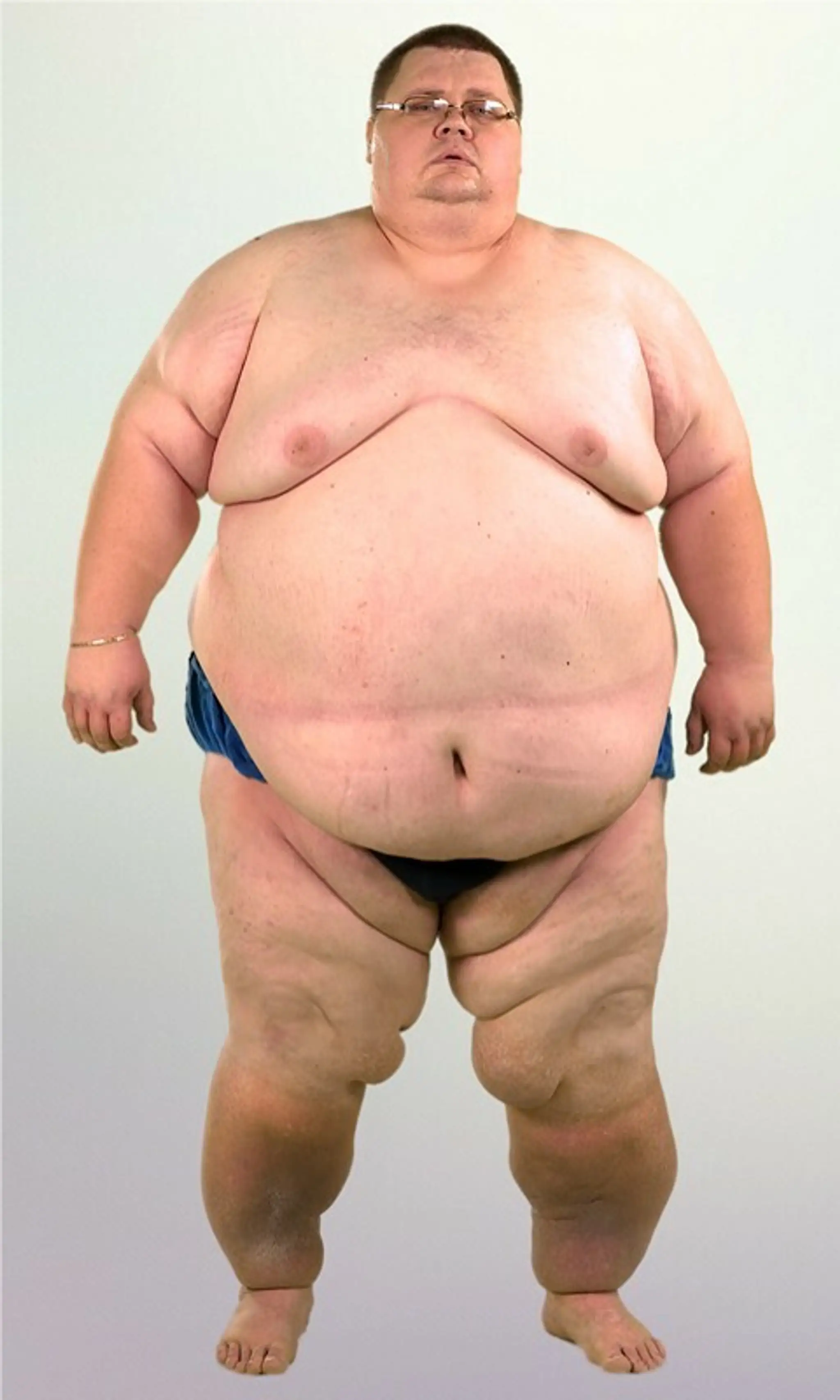 Ján Hodoň pred premenou vážil 287 kg
