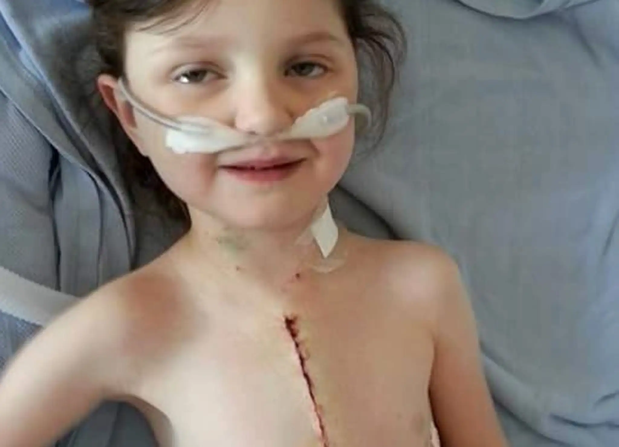 Vďaka lieku zvládla Cerys päť vážnych operácií