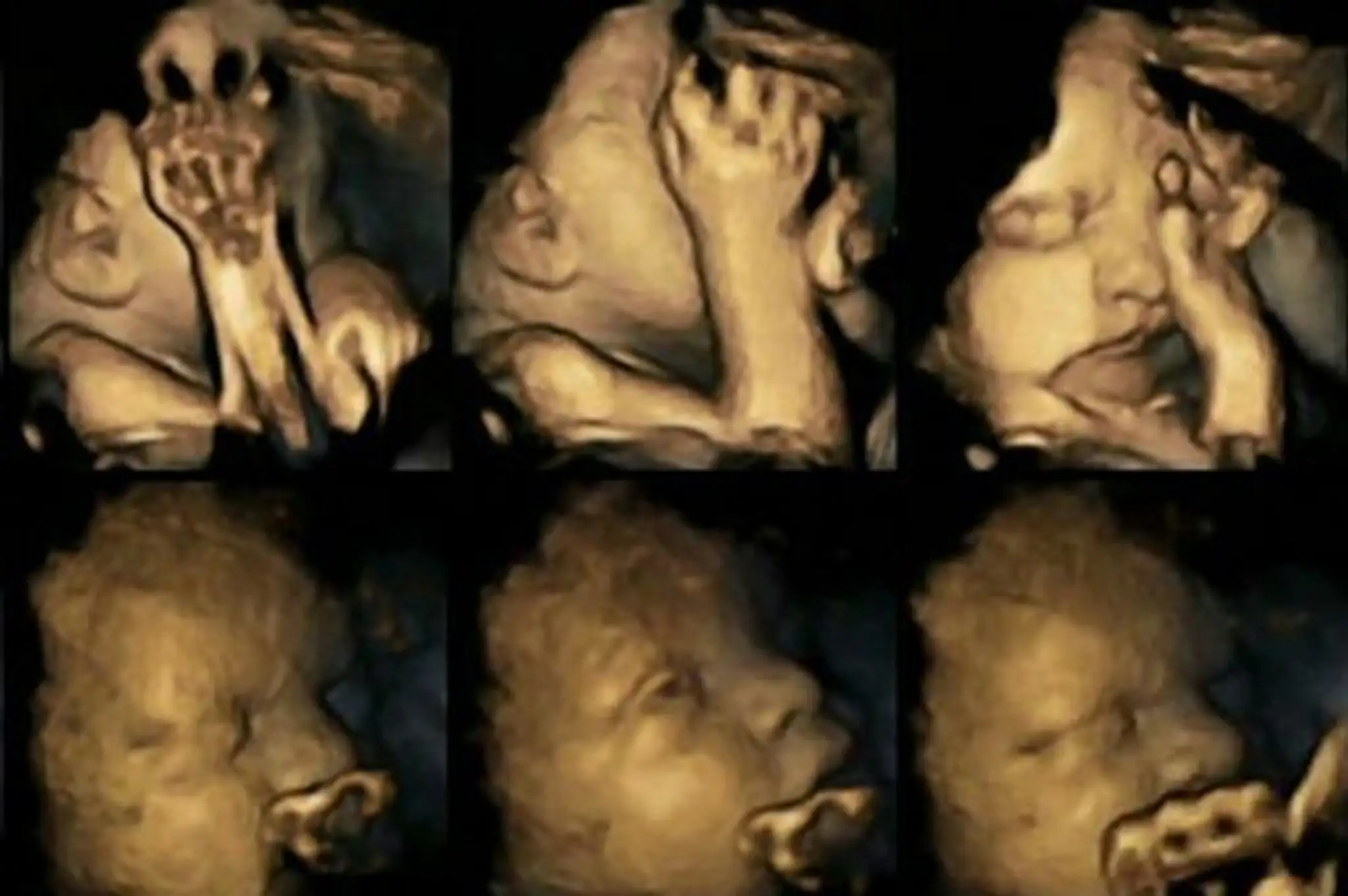 Fetus-2.jpg