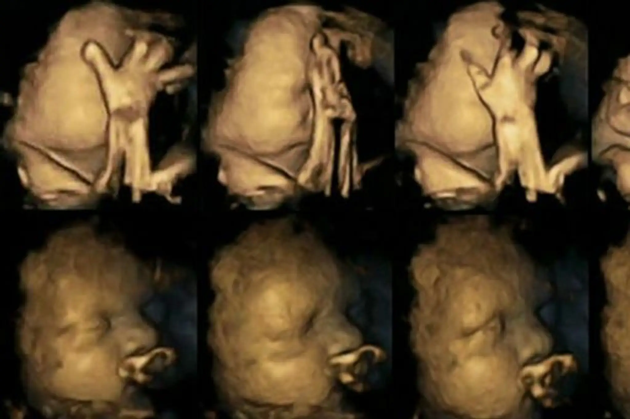 Fetus-1.jpg