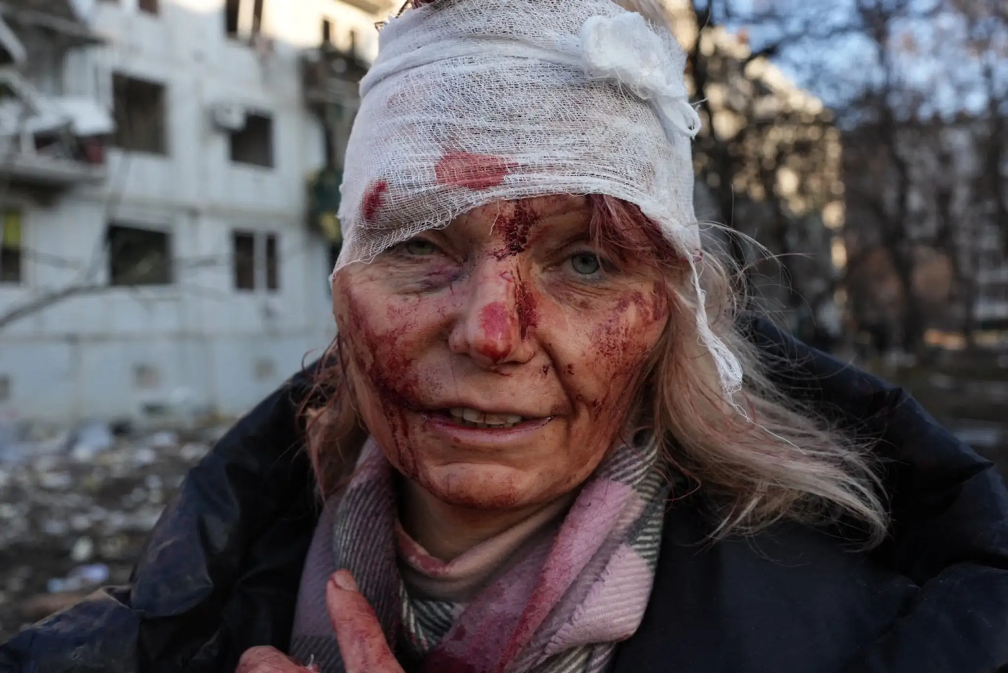 Zranená žena po nálete a poškodení bytového komplexu neďaleko Charkova na Ukrajine