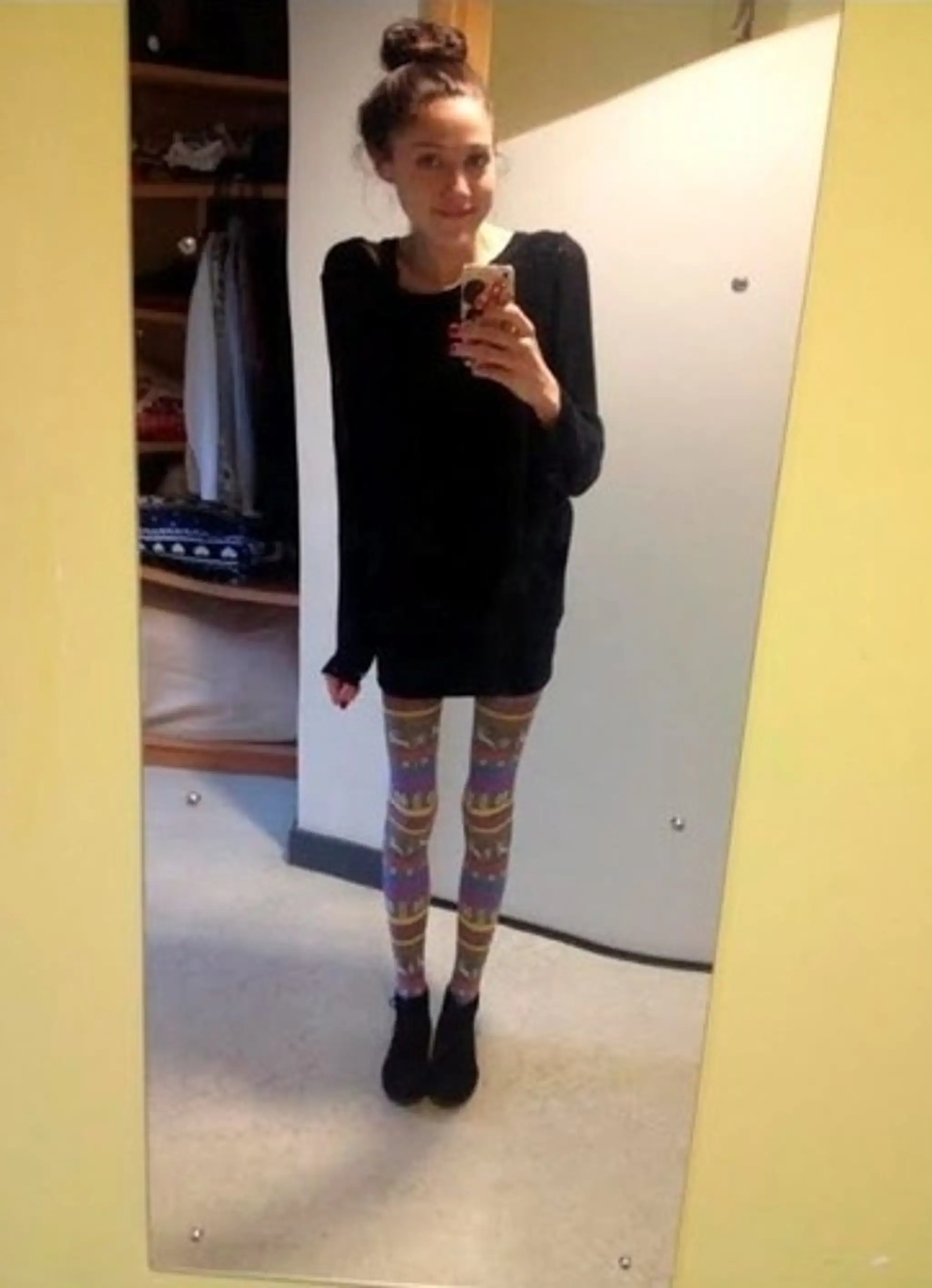 Emma Duffy trpí anorexiou už 16 rokov
