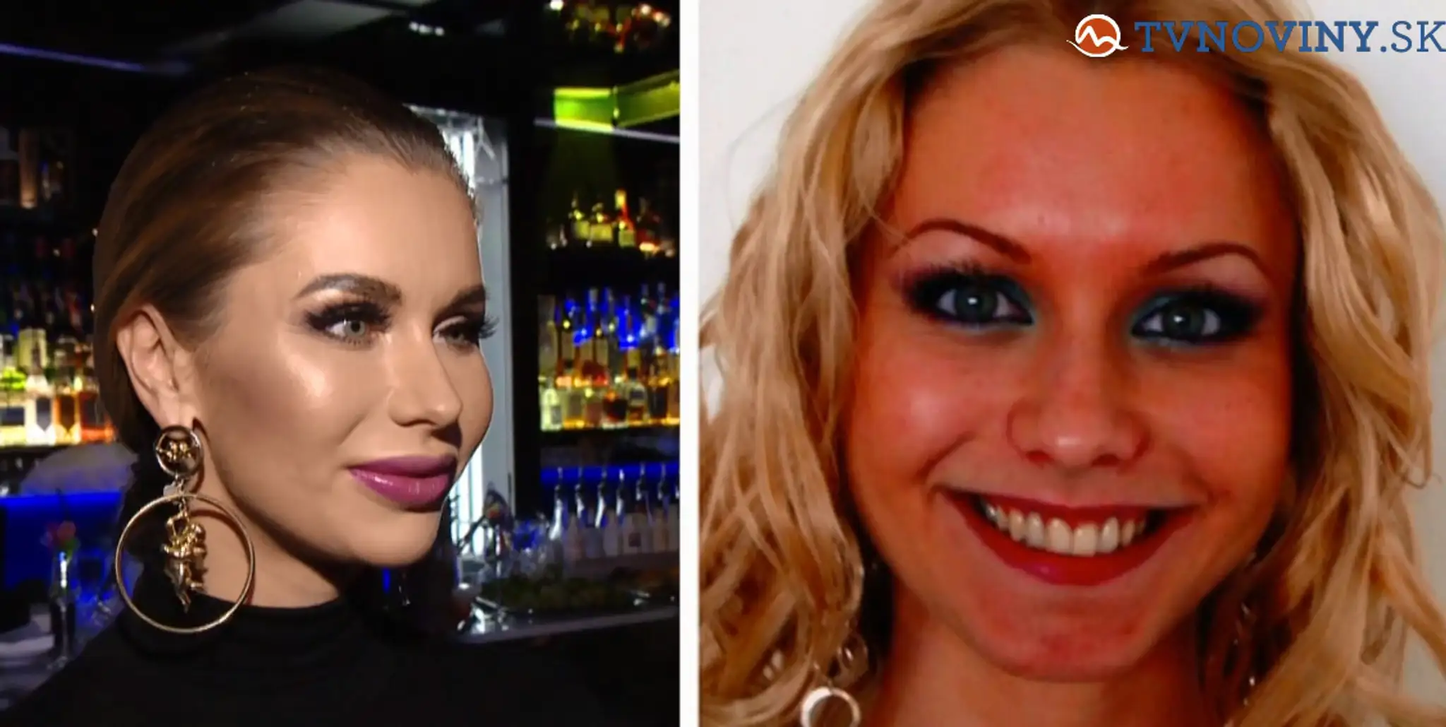 Modelka Eva Cifrová tvrdí, že má vylepšené prsia a tým to končí