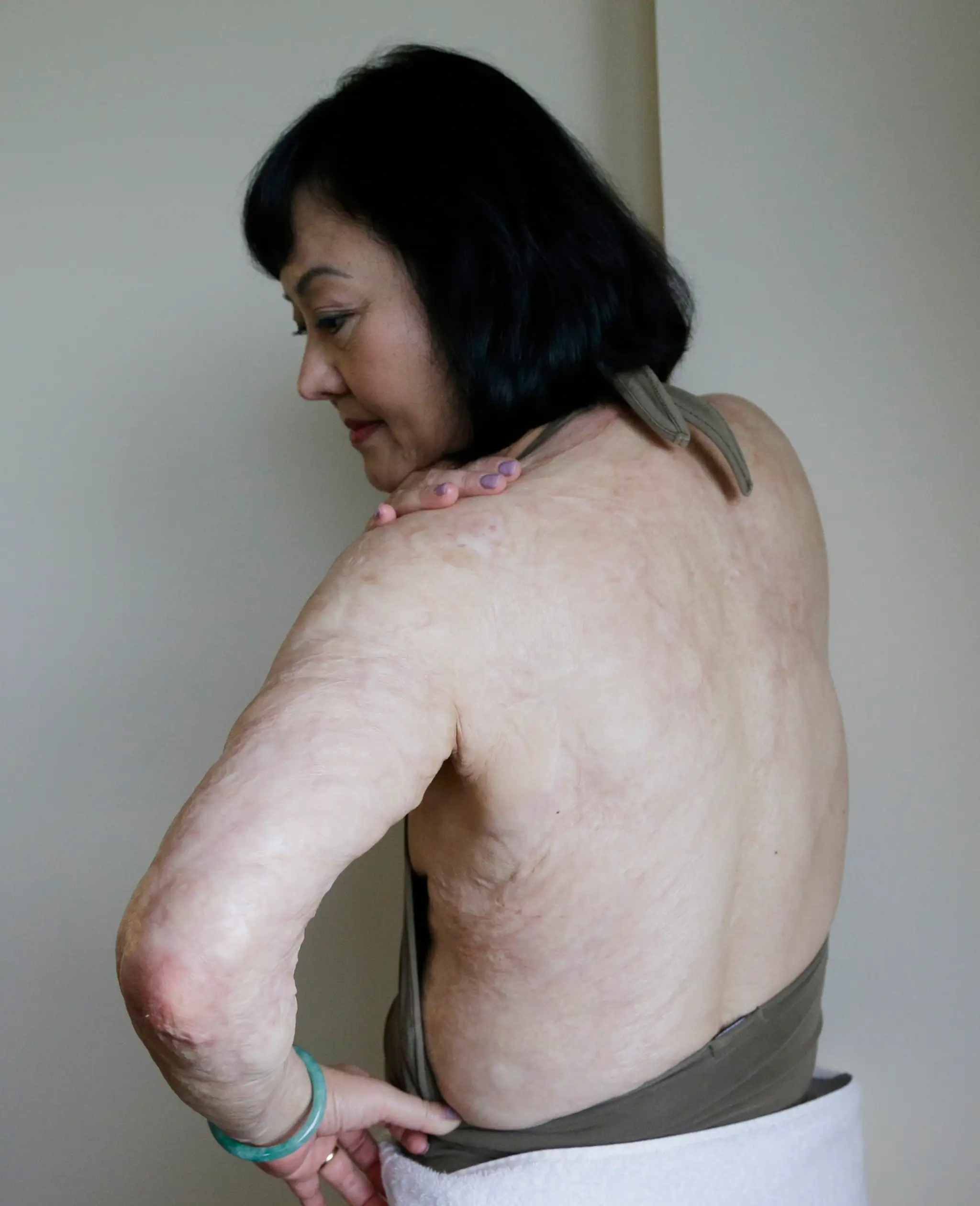 Kim Phuc