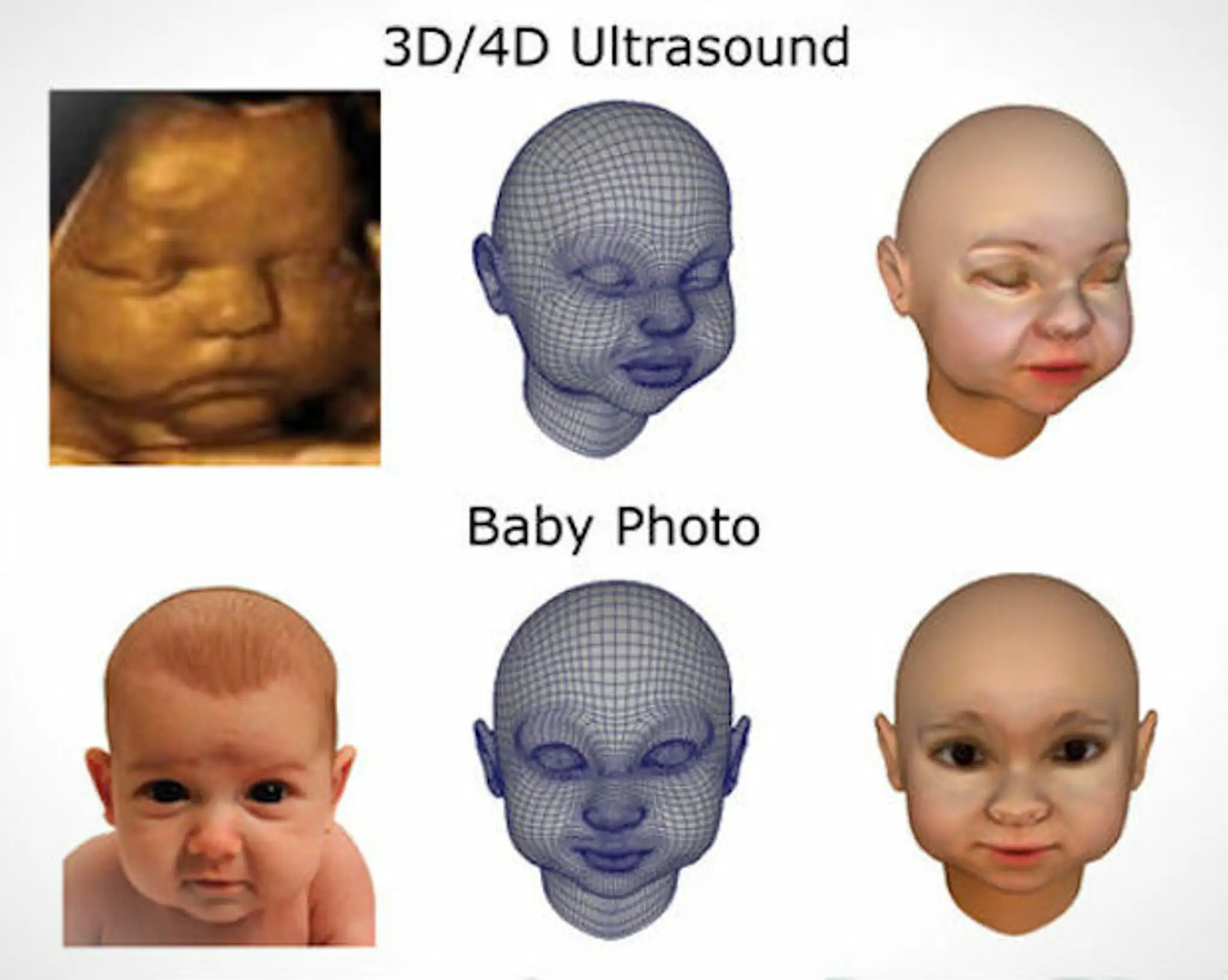 Ešte nenarodené dieťa vytlačené 3D tlačiarňou