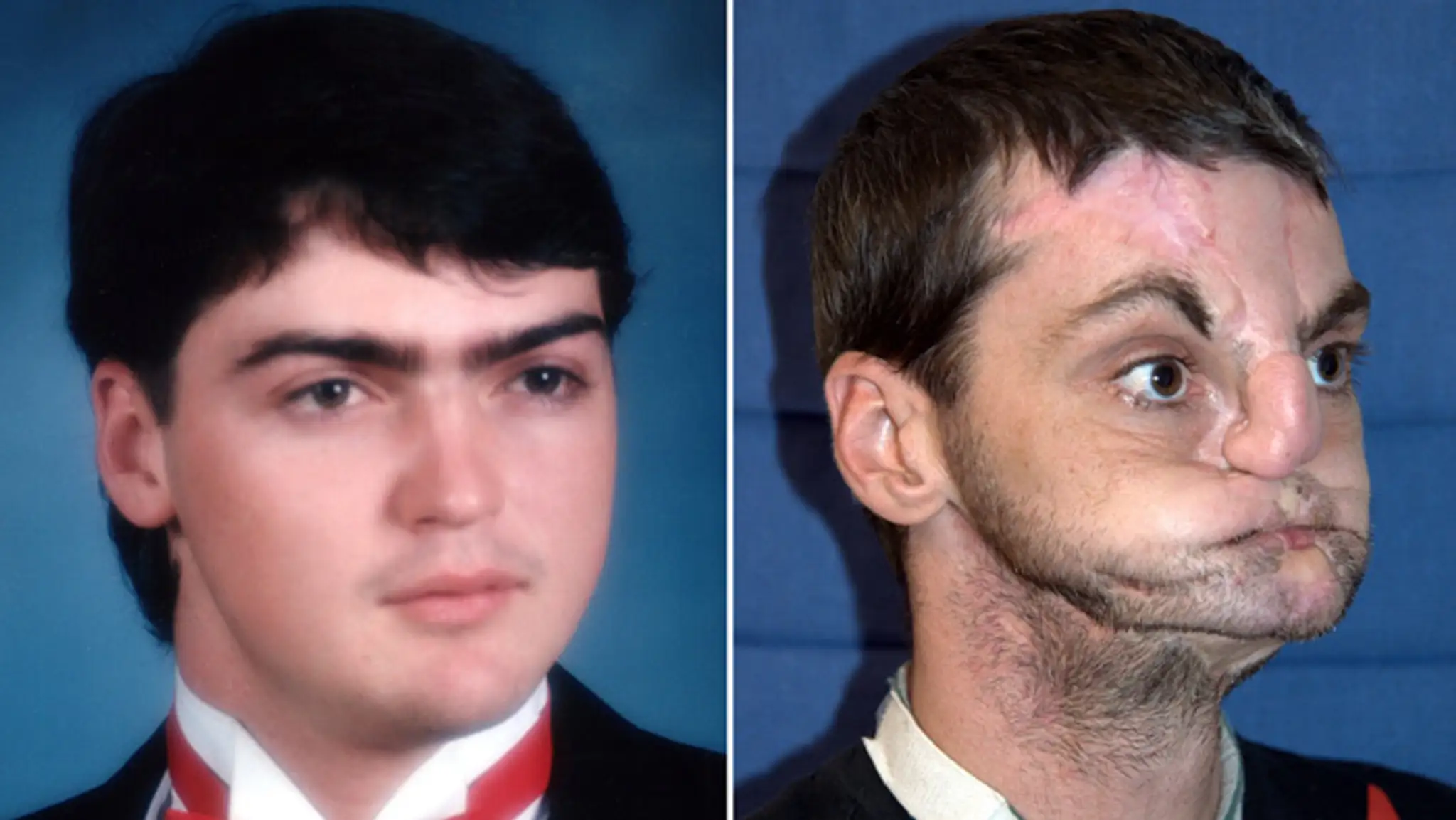 Joshua(vľavo) zomrel pri dopravnej nehode. Richard sa vážne zranil pri nešťastnom výstrele.