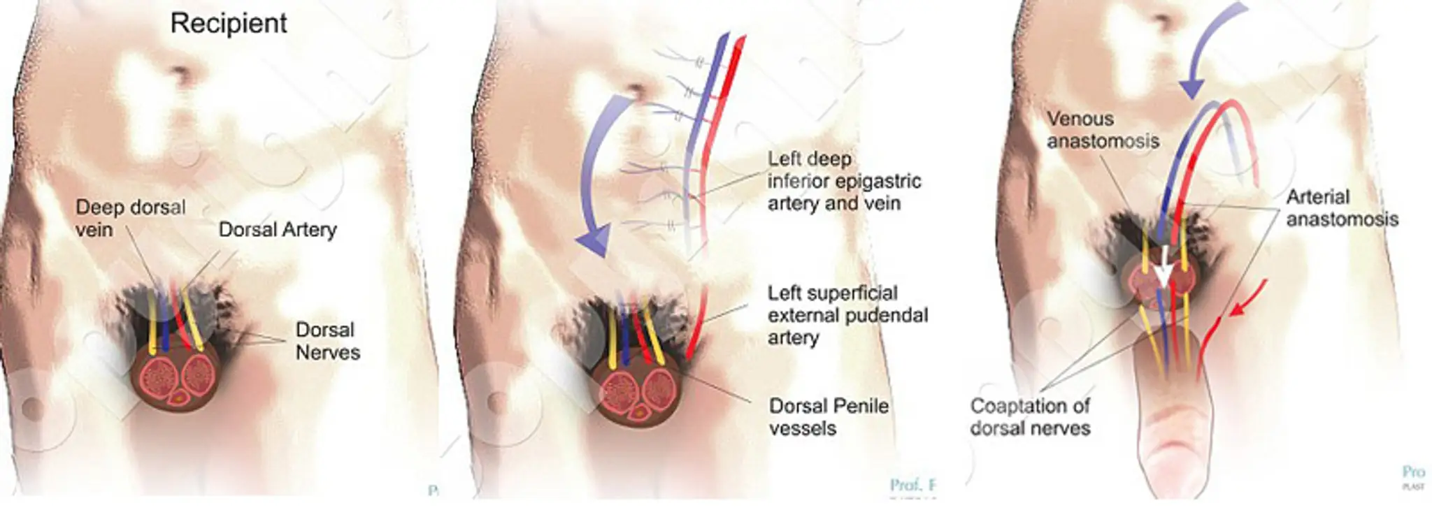 penis2.jpg