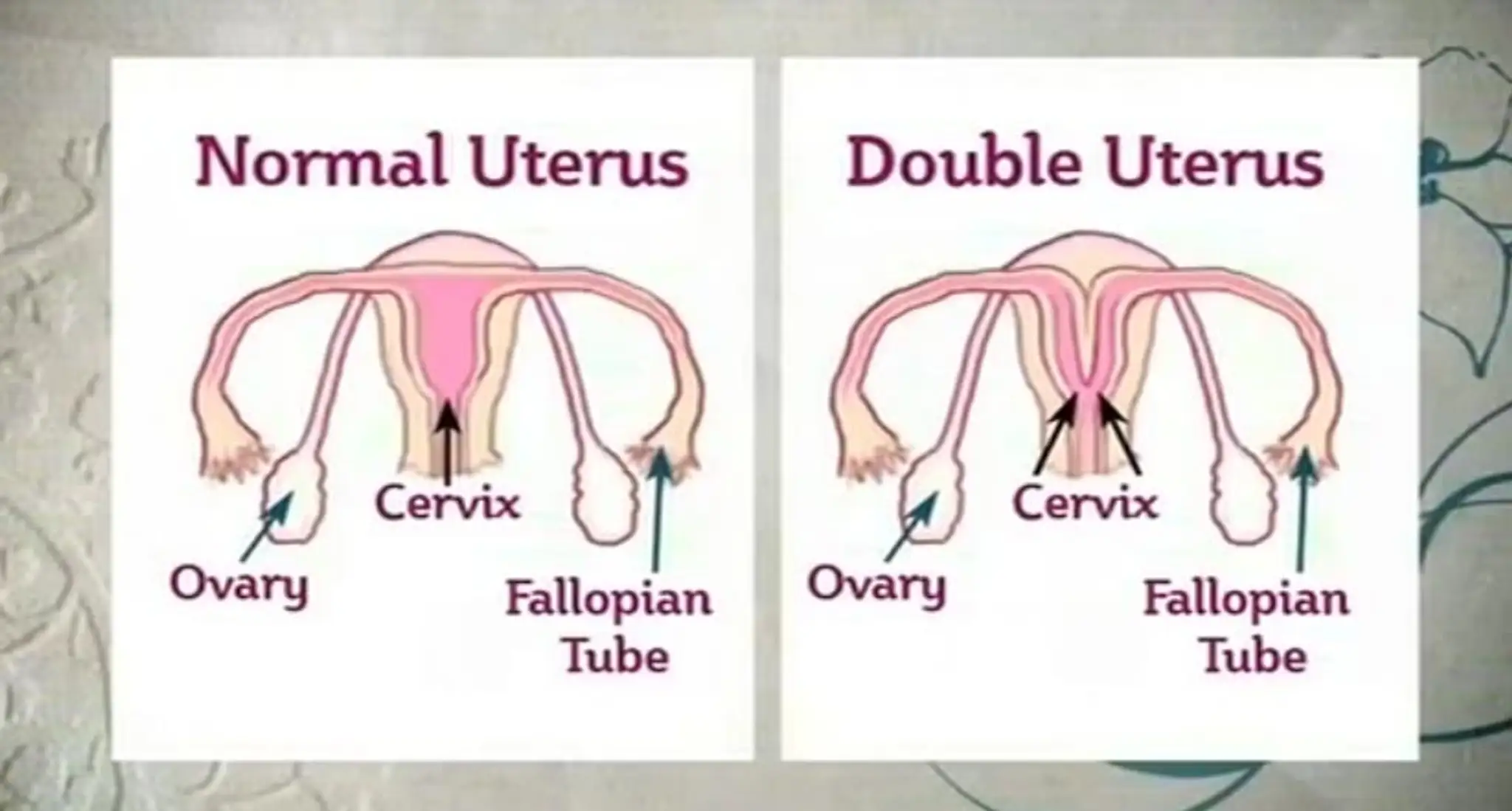 vagina.jpg