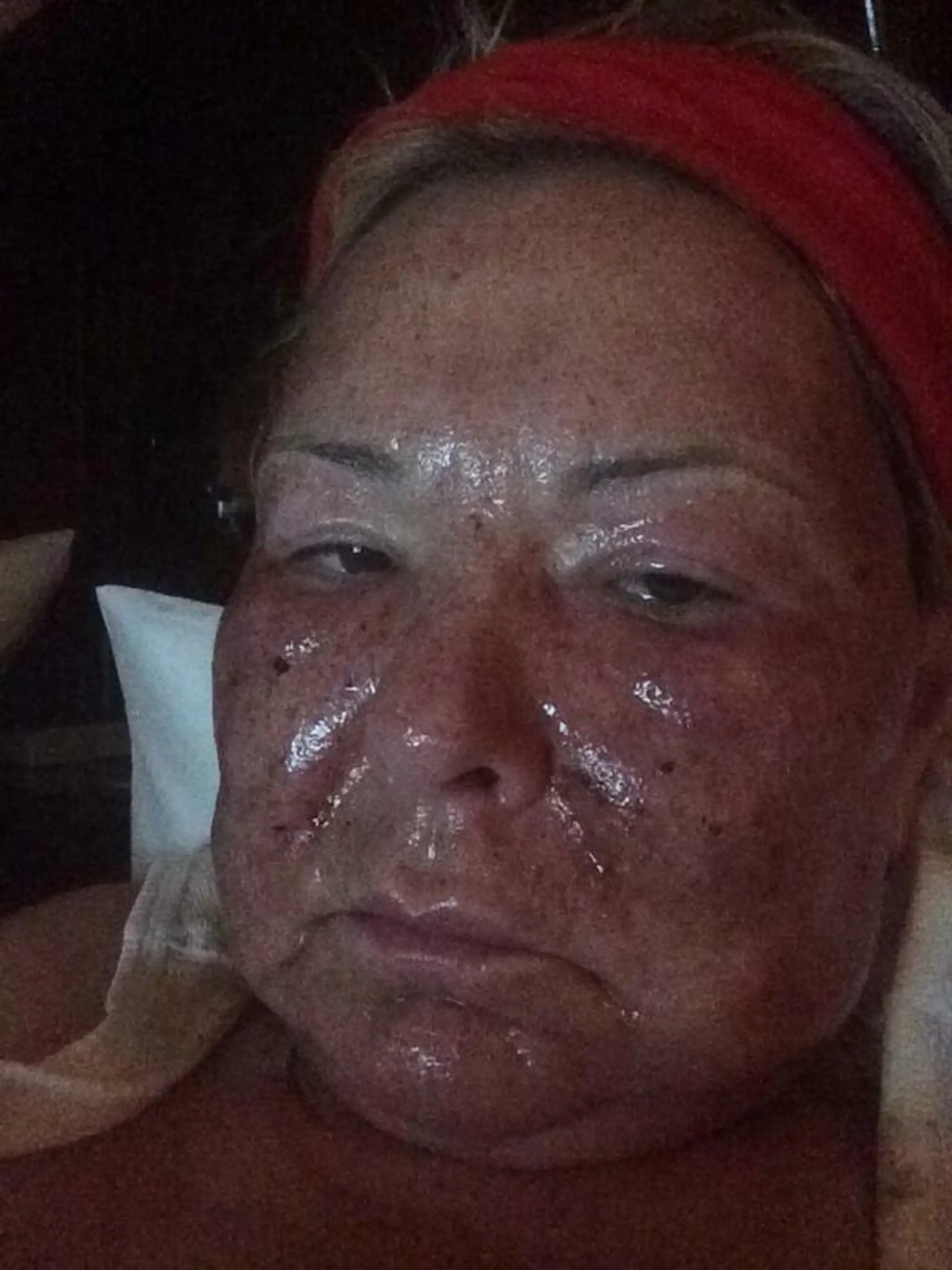 Roseanne Barr po plastike.