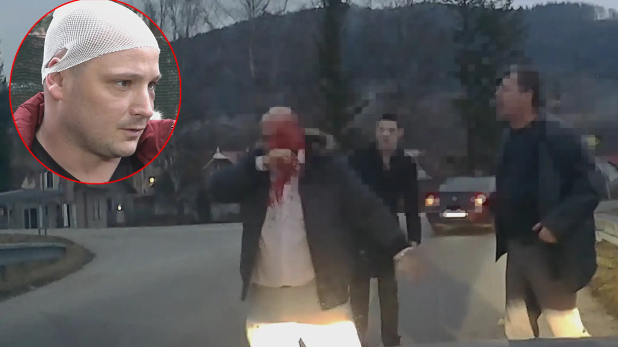 Napadnutý vodič Peter