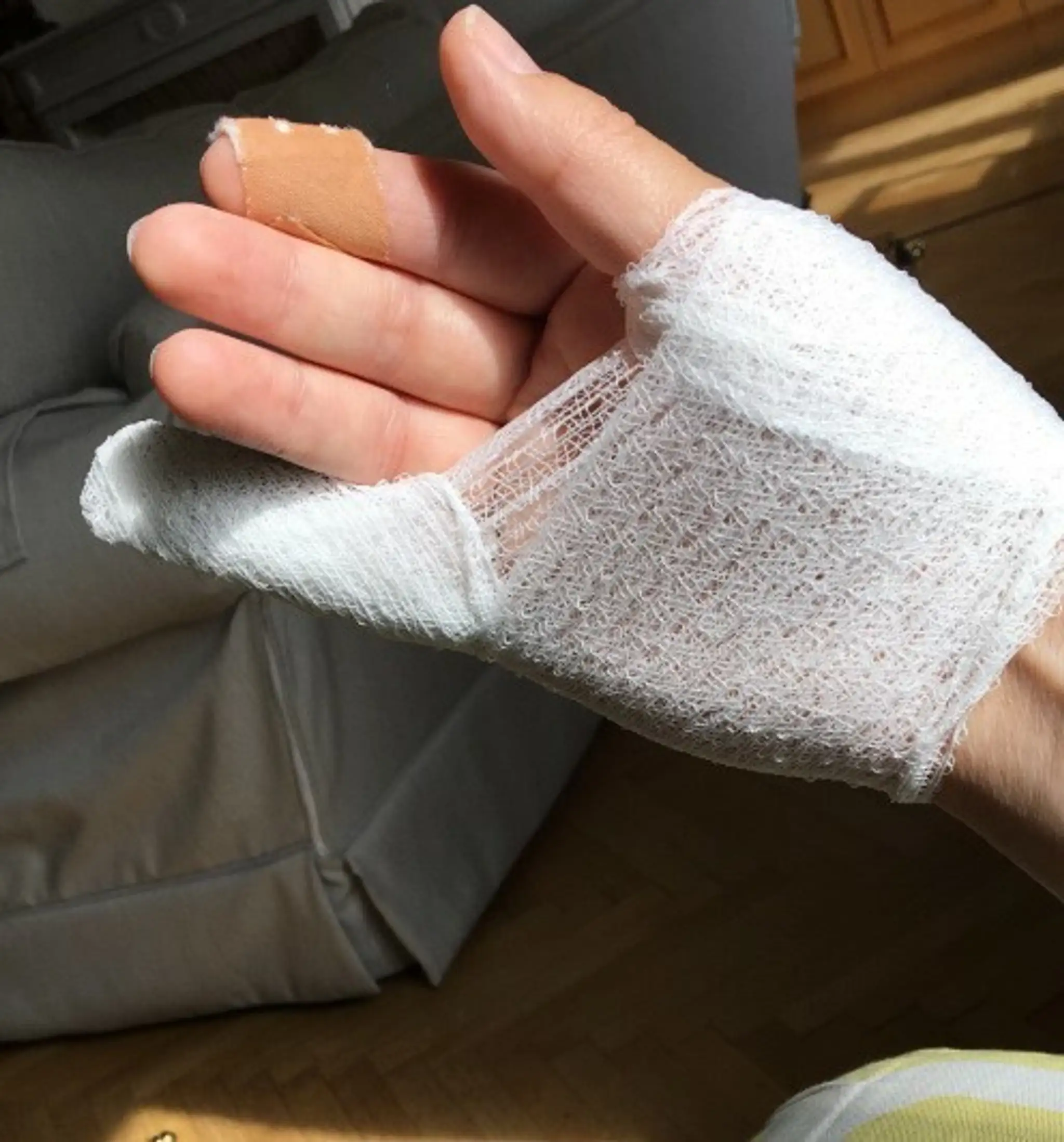 Ľahké zranenie, ktoré si spôsobil veľvyslanec pádom.