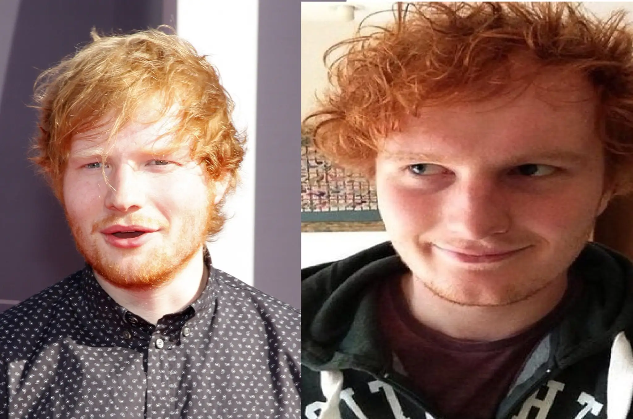 Ed Sheeran.