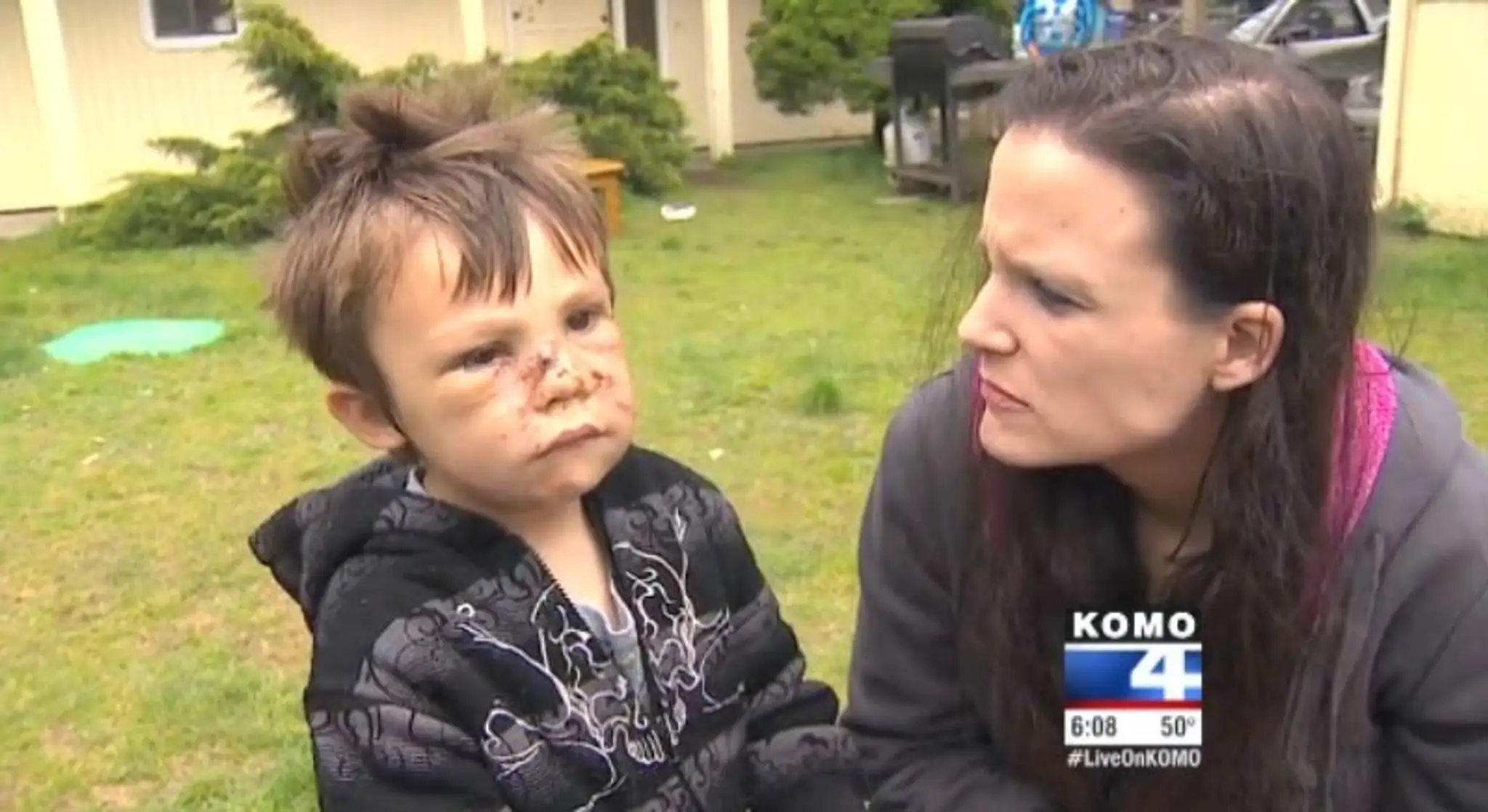 Gavina Tobecka napadol pitbul.